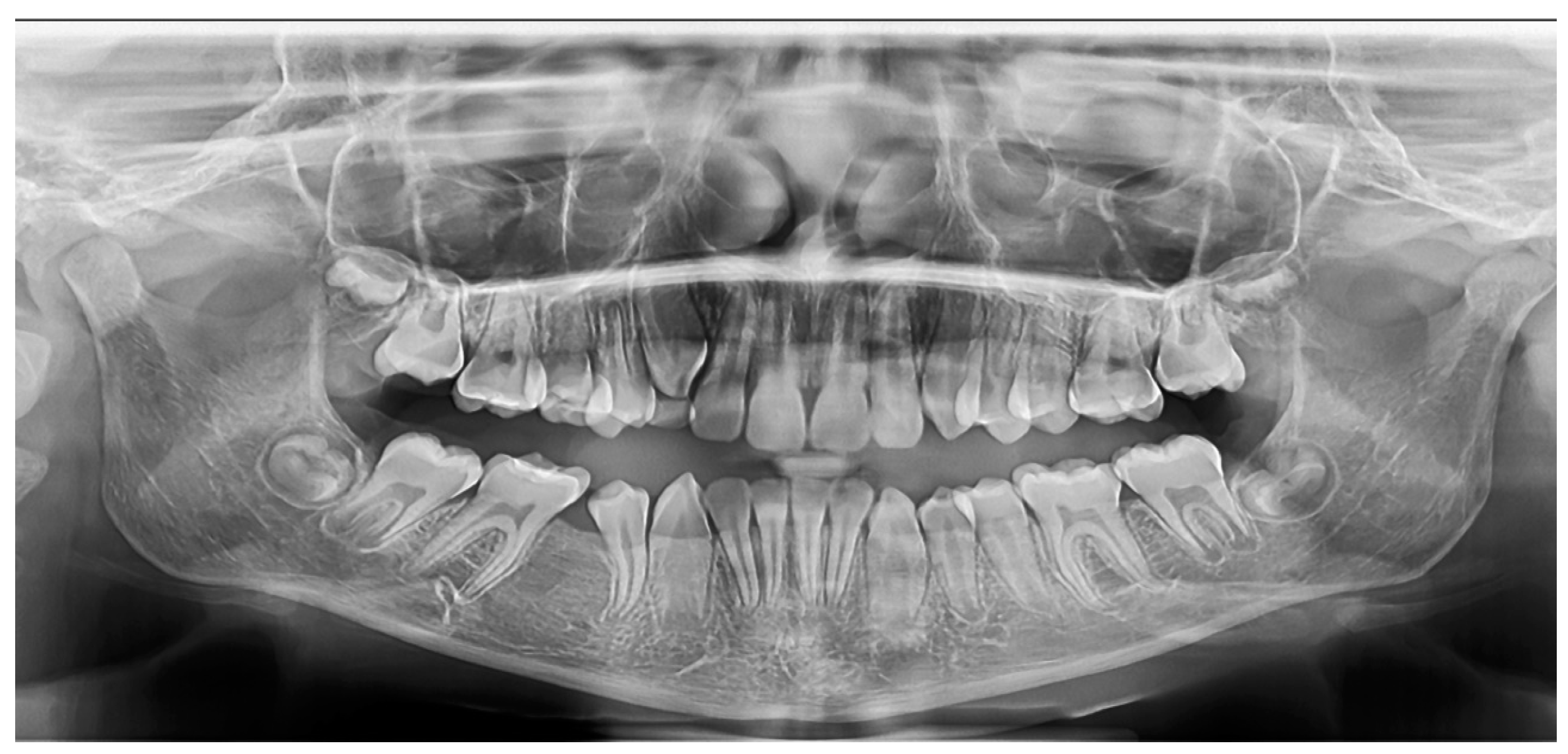 Medicina 60 01133 g004 Medicina 60 01133 g004