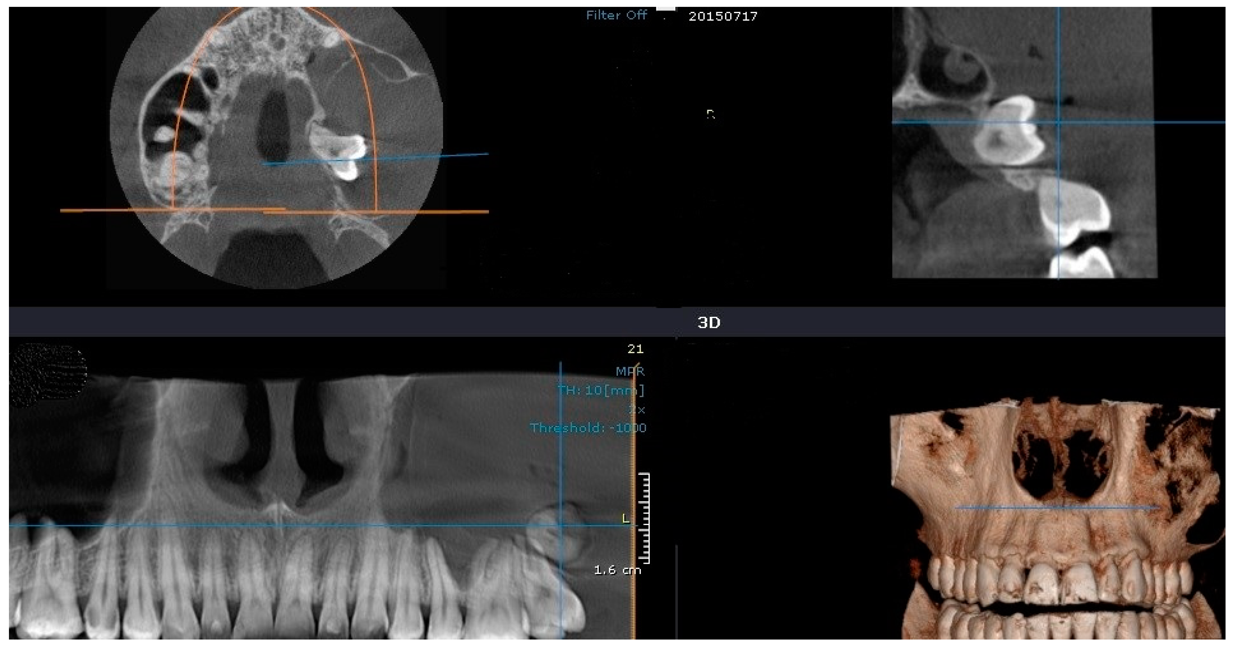 Medicina 60 01133 g005 Medicina 60 01133 g005