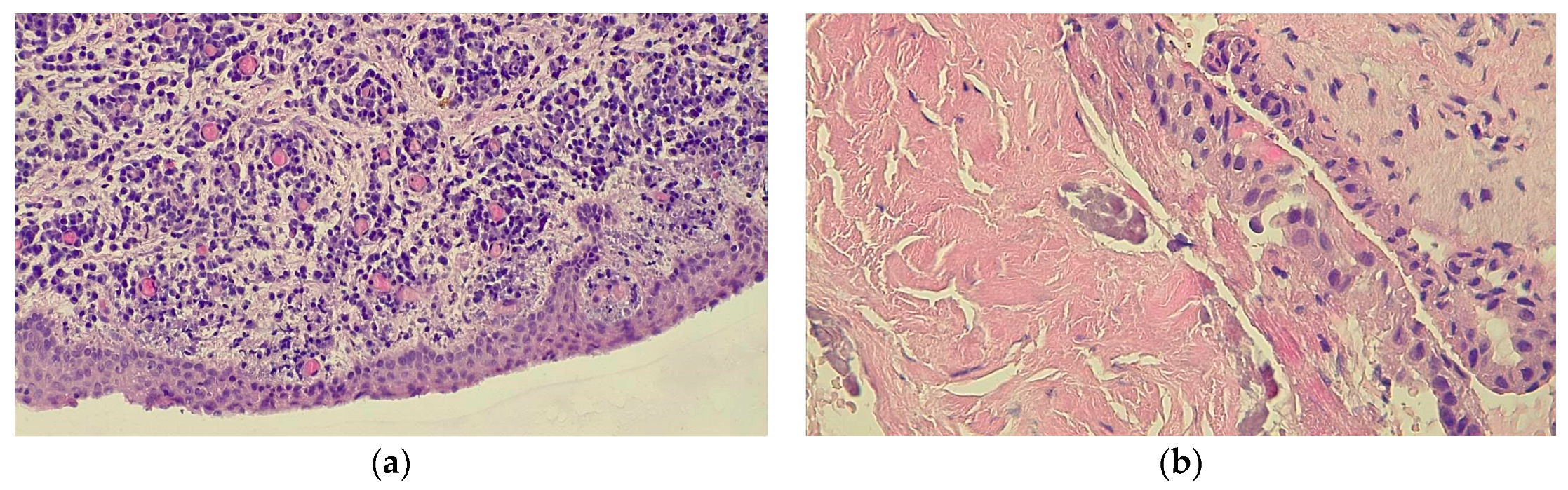 Medicina 60 01133 g007 Medicina 60 01133 g007