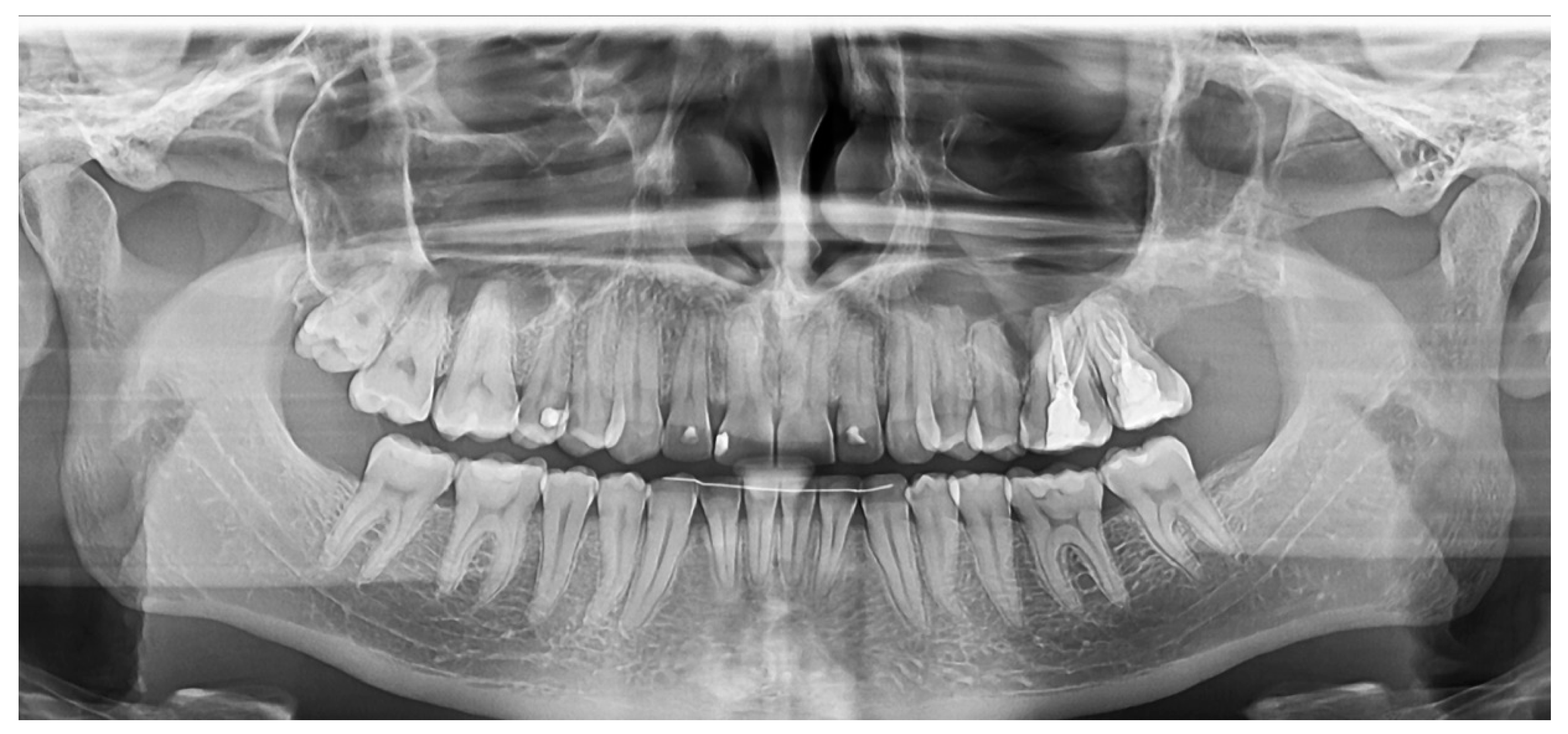 Medicina 60 01133 g008 Medicina 60 01133 g008