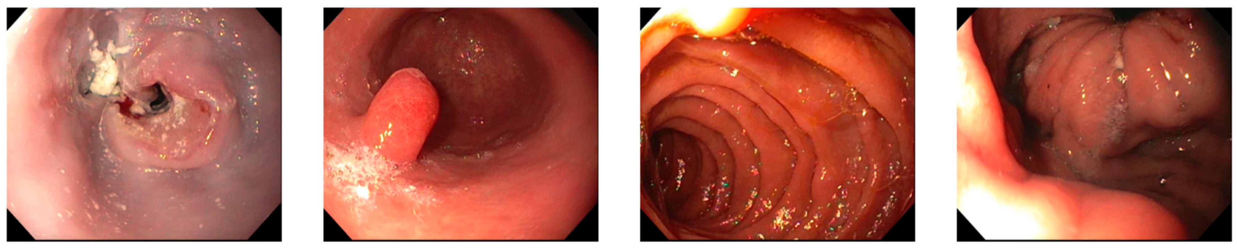 Medicina 60 01146 g001