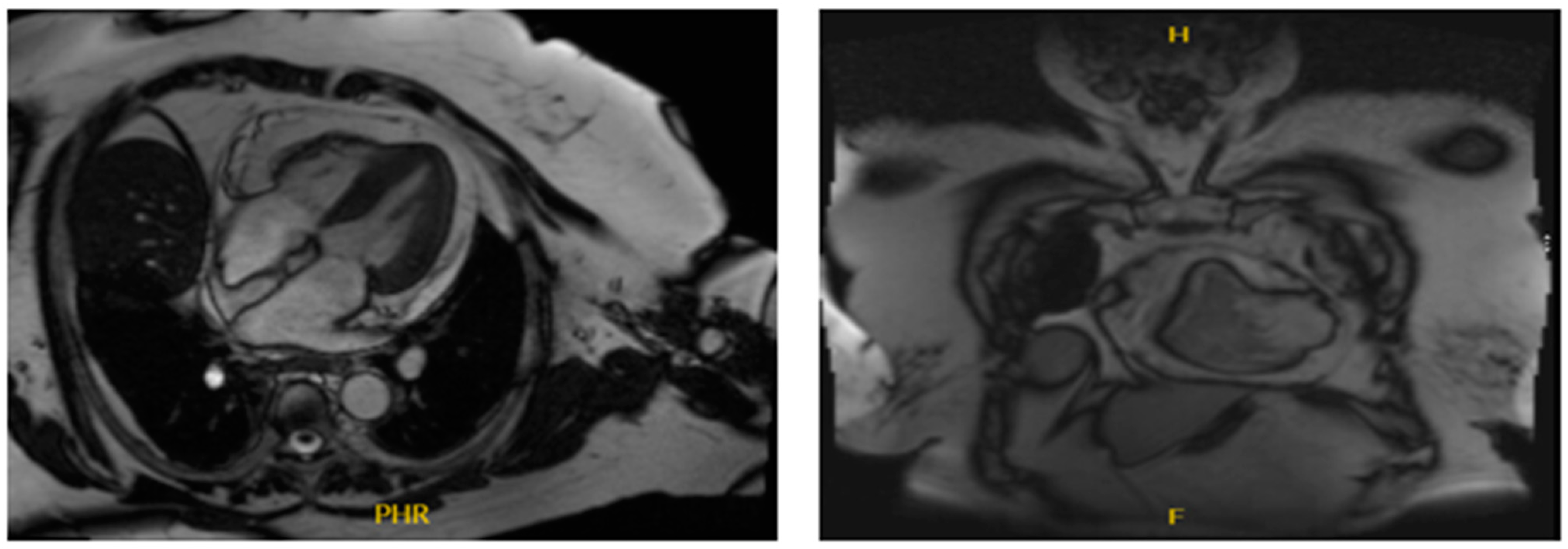 Medicina 60 01146 g002
