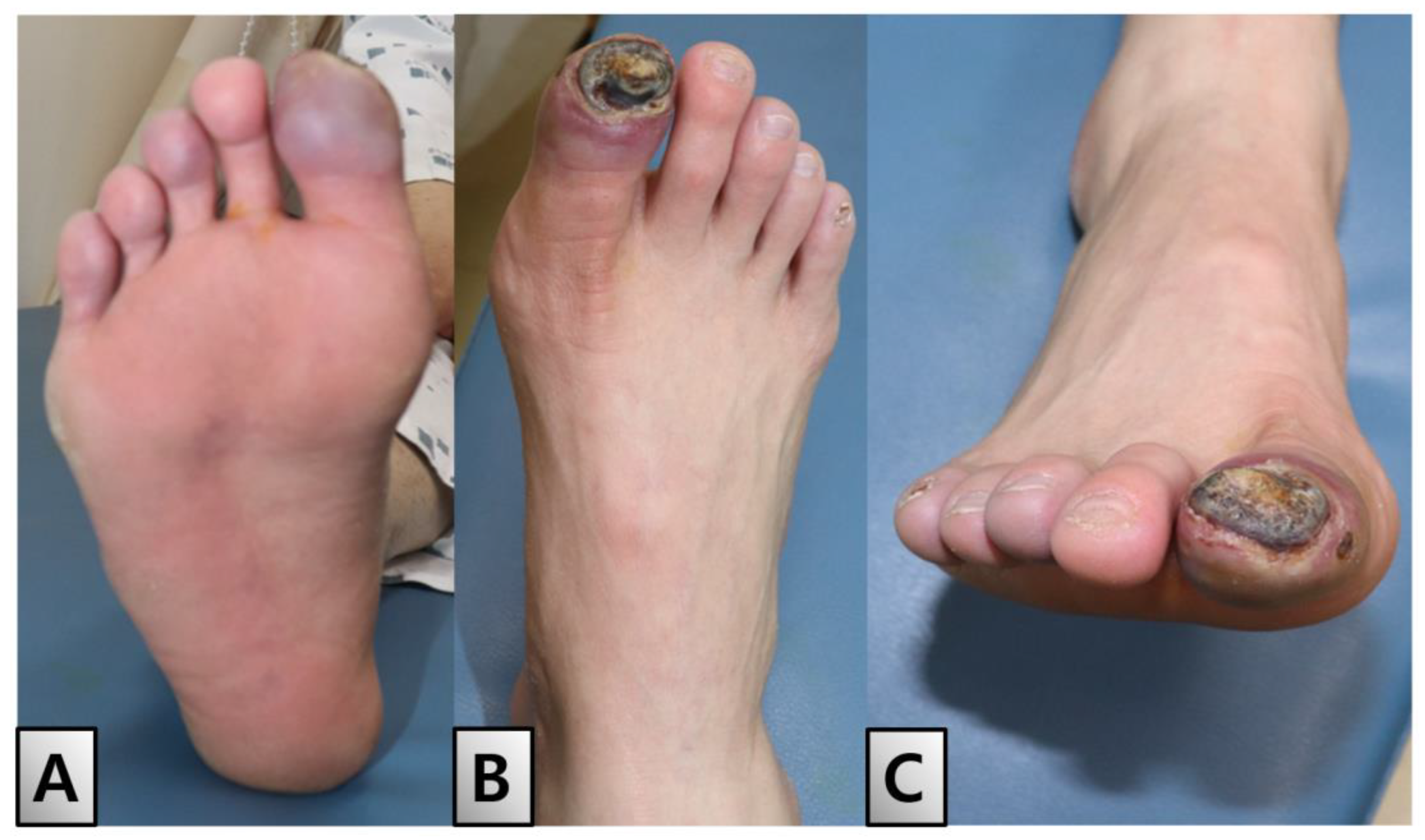 Medicina 60 01147 g001