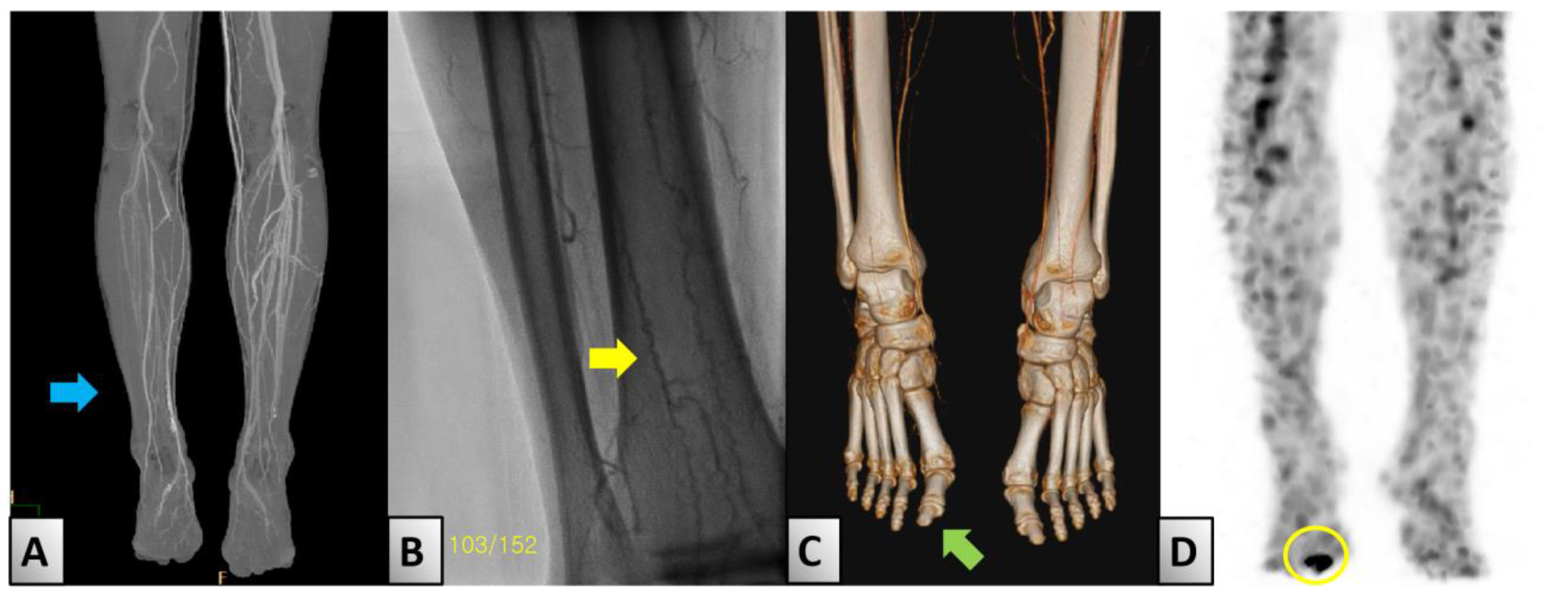 Medicina 60 01147 g002