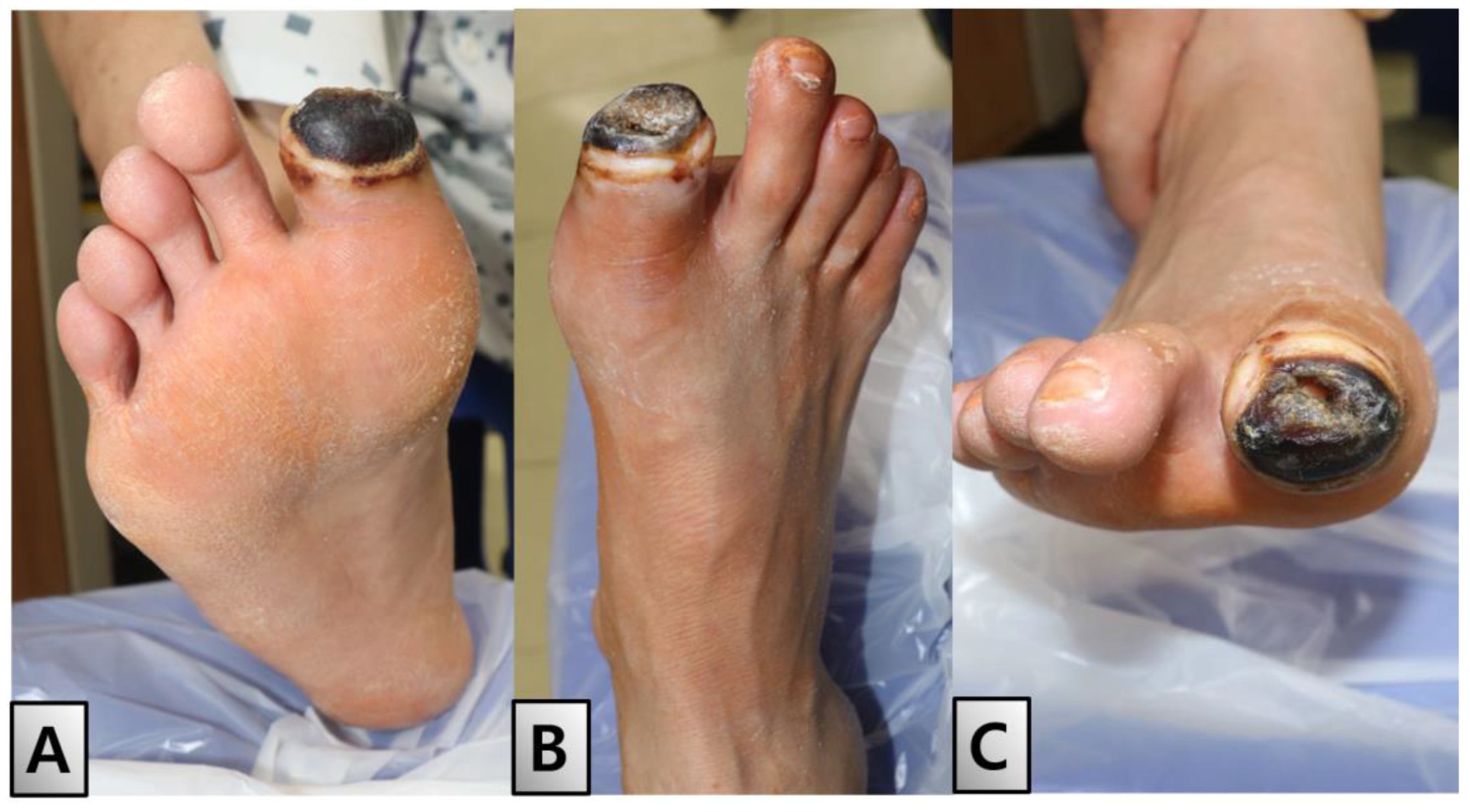 Medicina 60 01147 g003