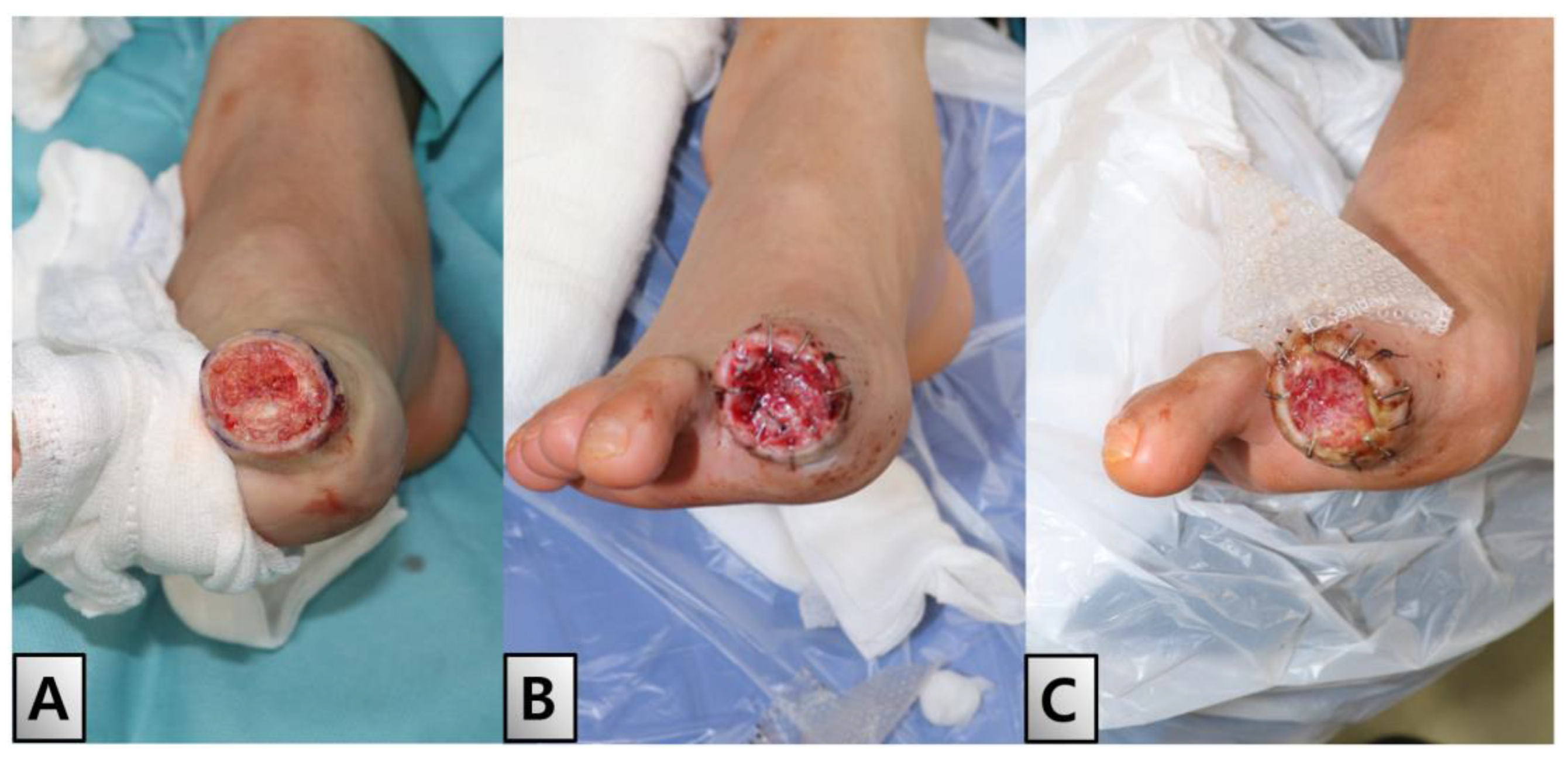 Medicina 60 01147 g004