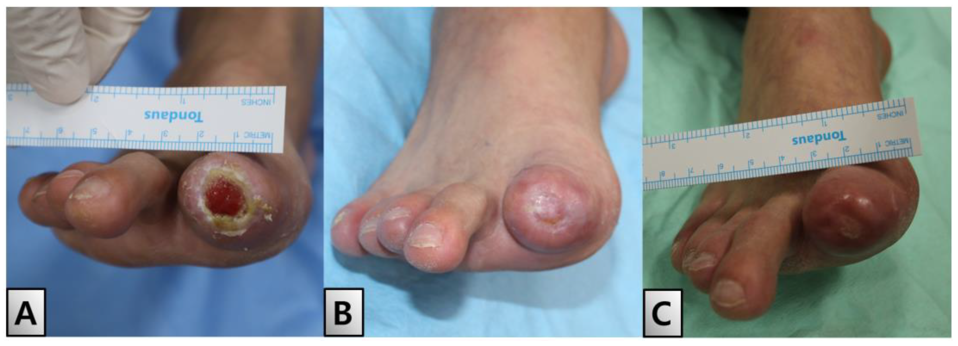 Medicina 60 01147 g005