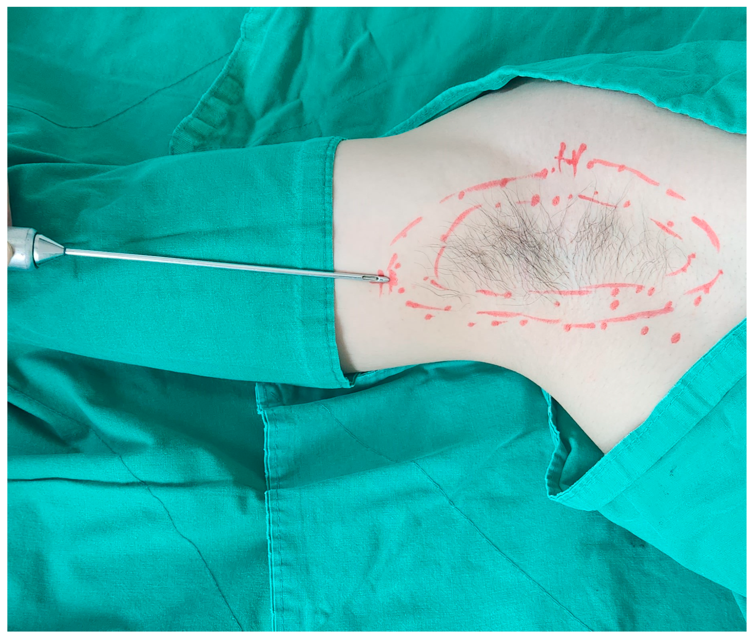 Medicina 60 01151 g002