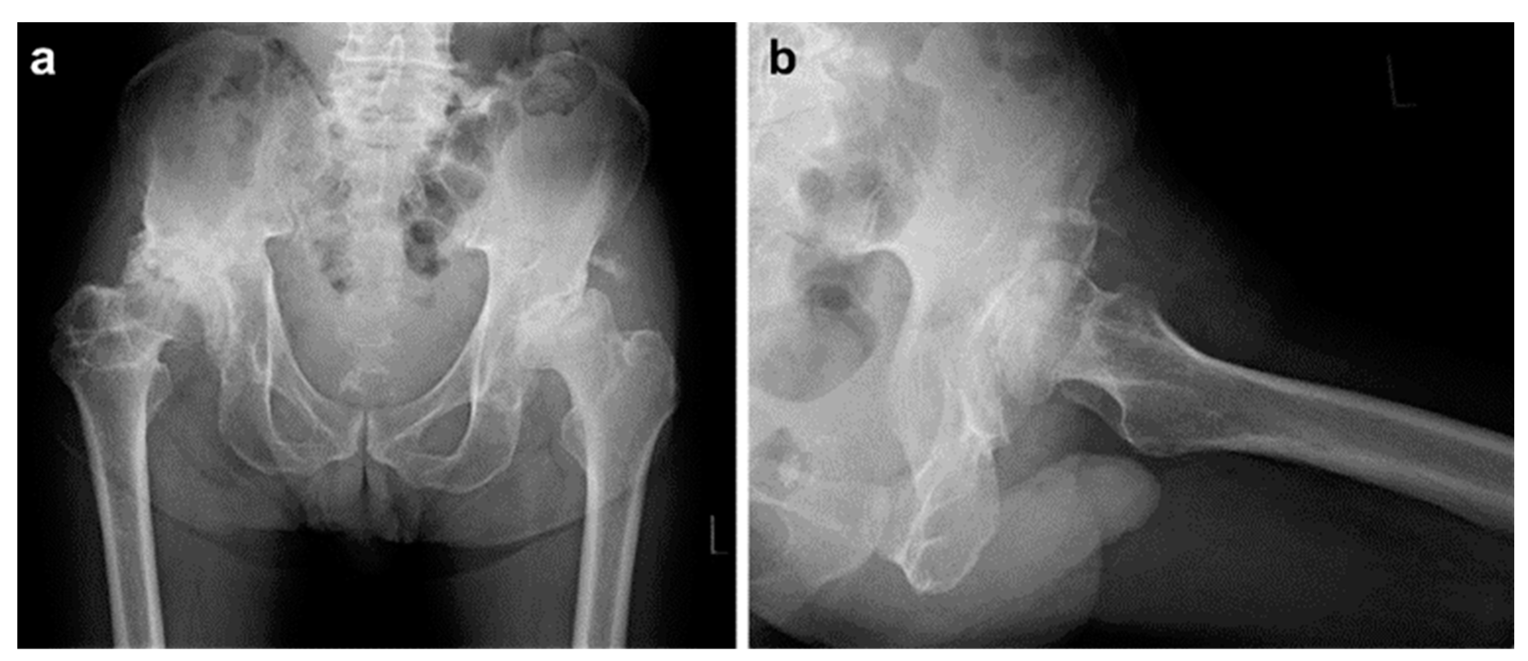 Medicina 60 01154 g002