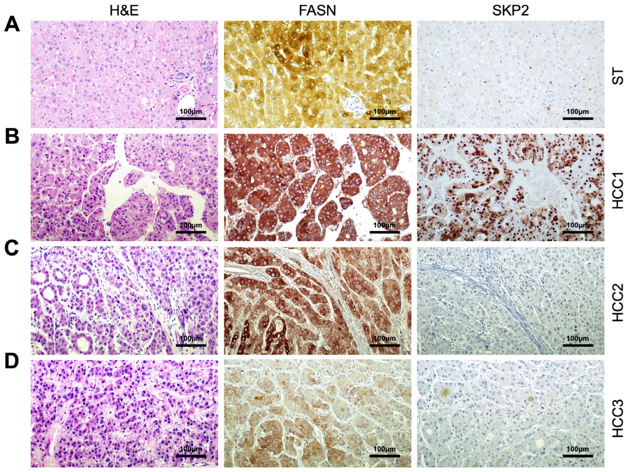Medicina 60 01160 g005