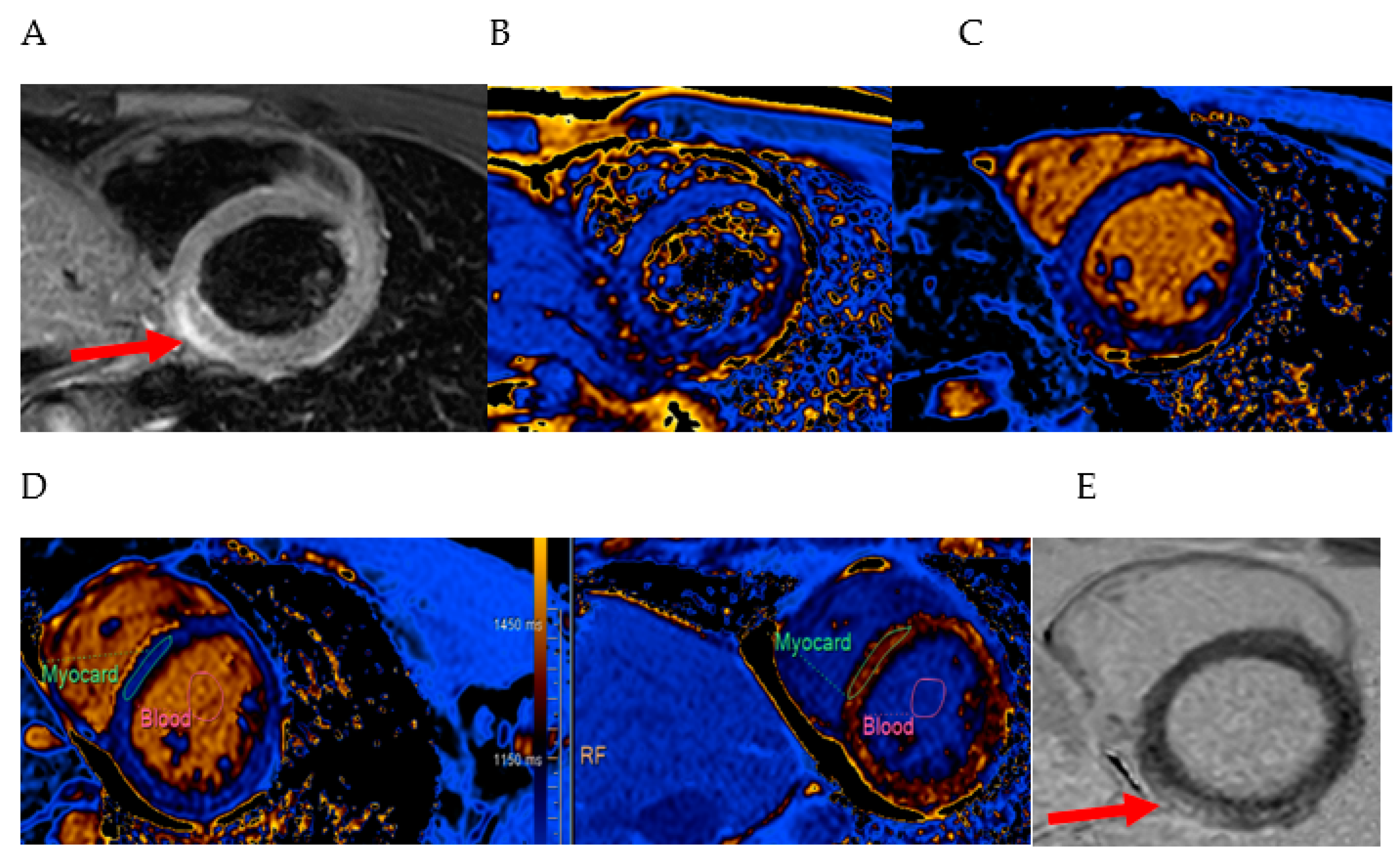 Medicina 60 01162 g002