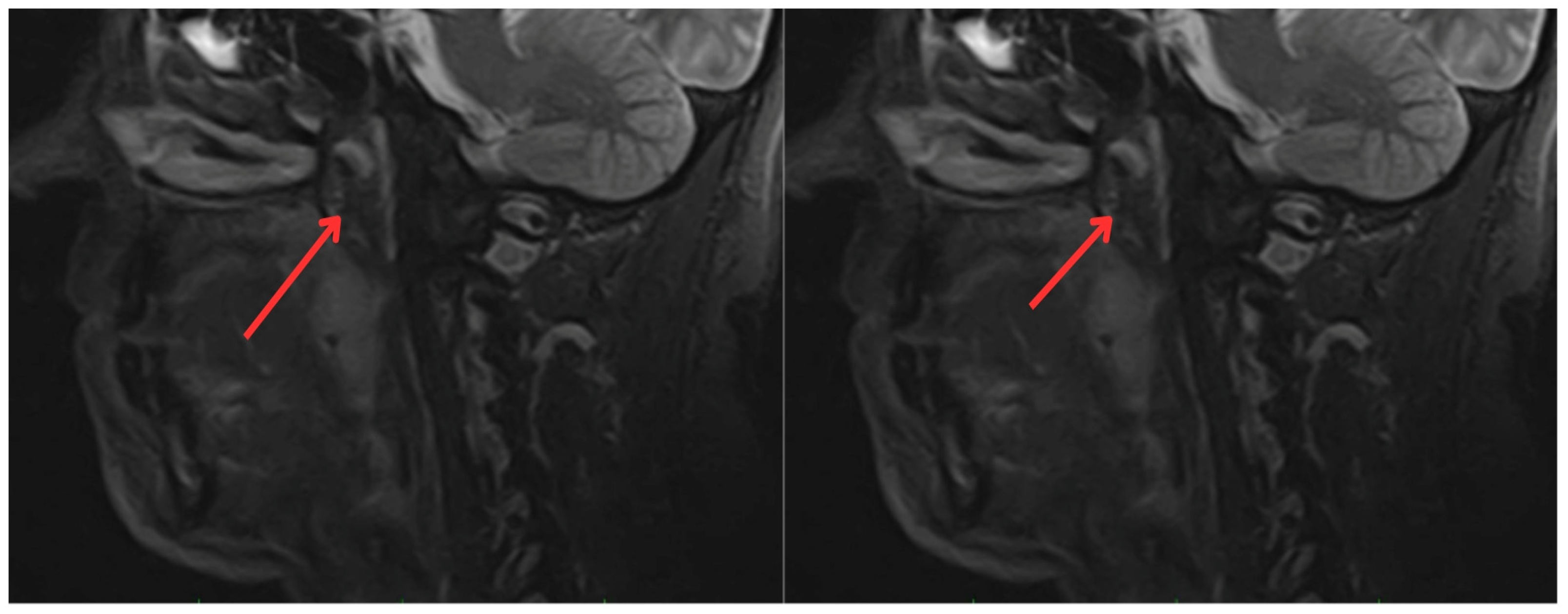 Medicina 60 01172 g003