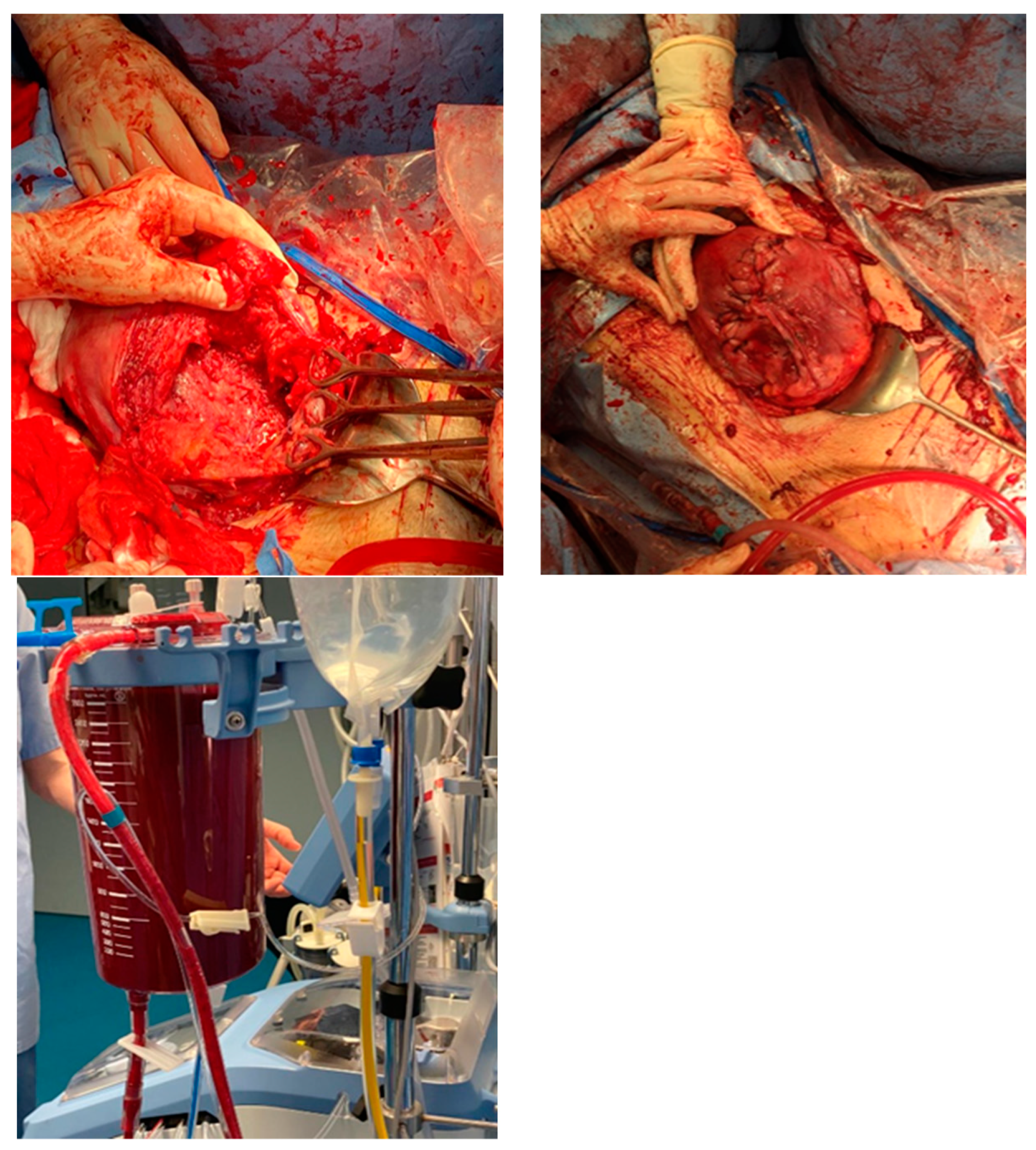 Medicina 60 01180 g003