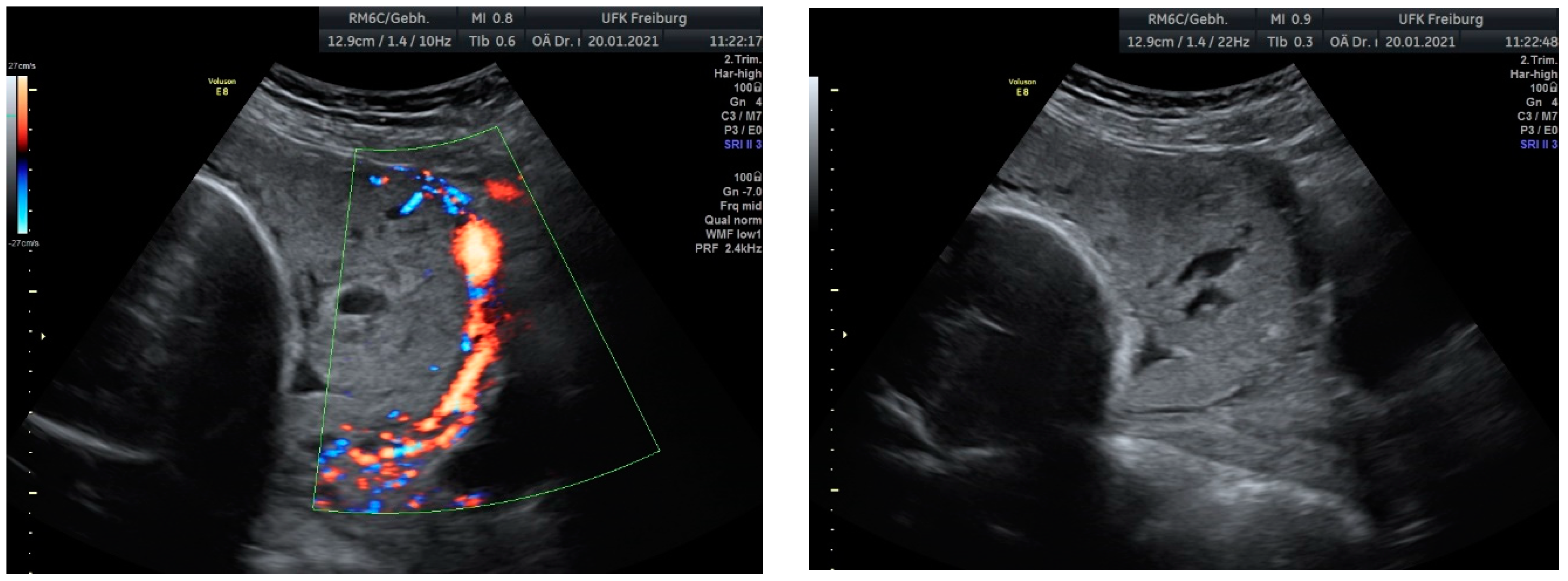 Medicina 60 01180 g004a