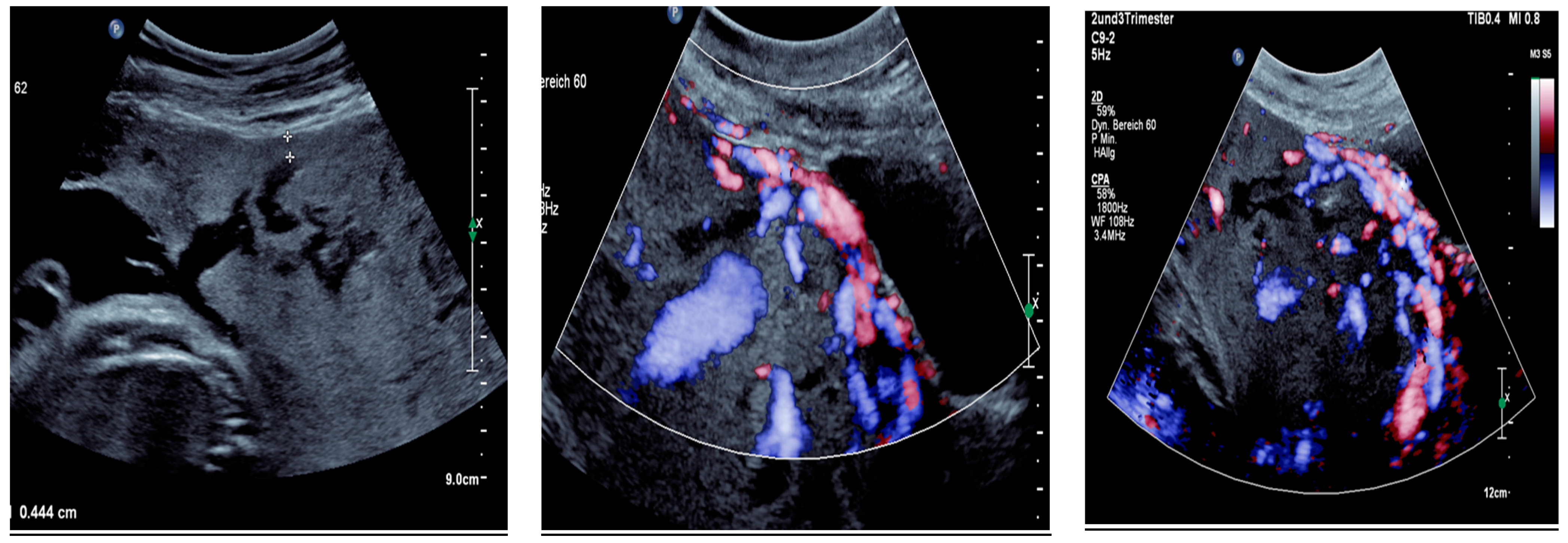 Medicina 60 01180 g007