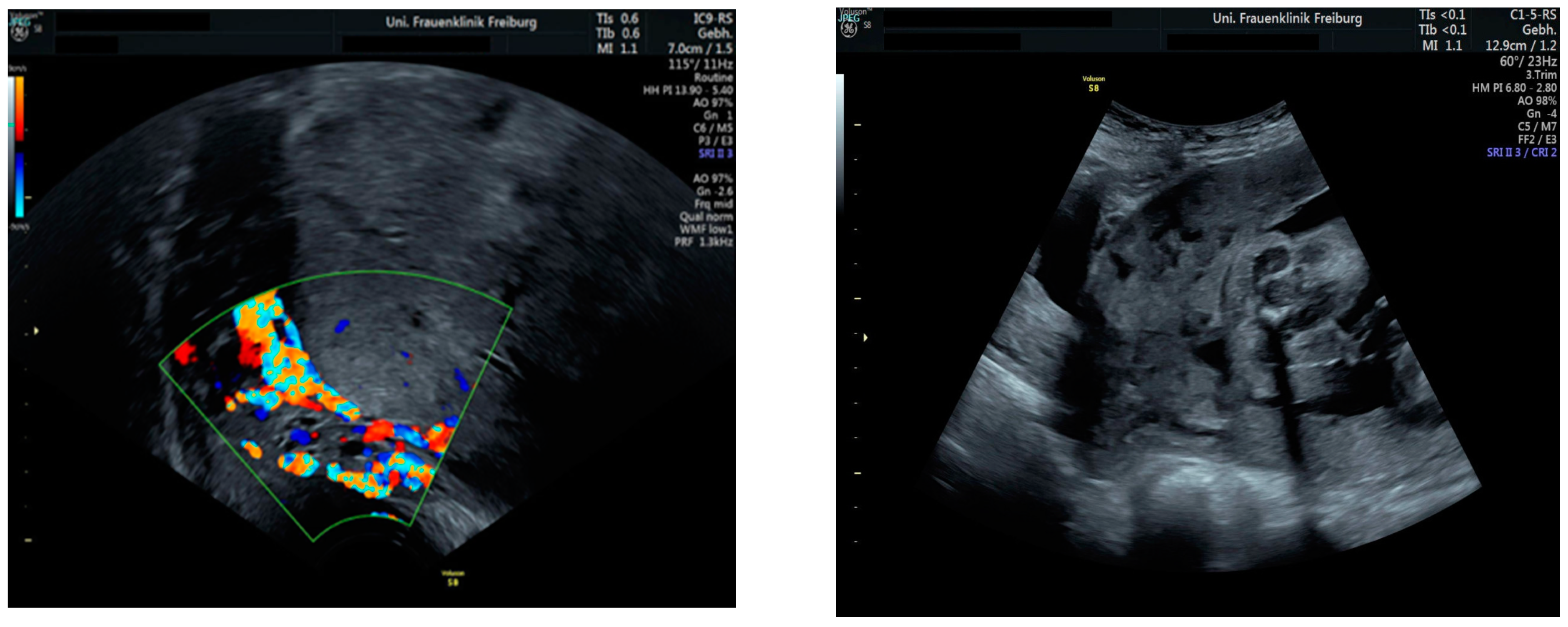 Medicina 60 01180 g011