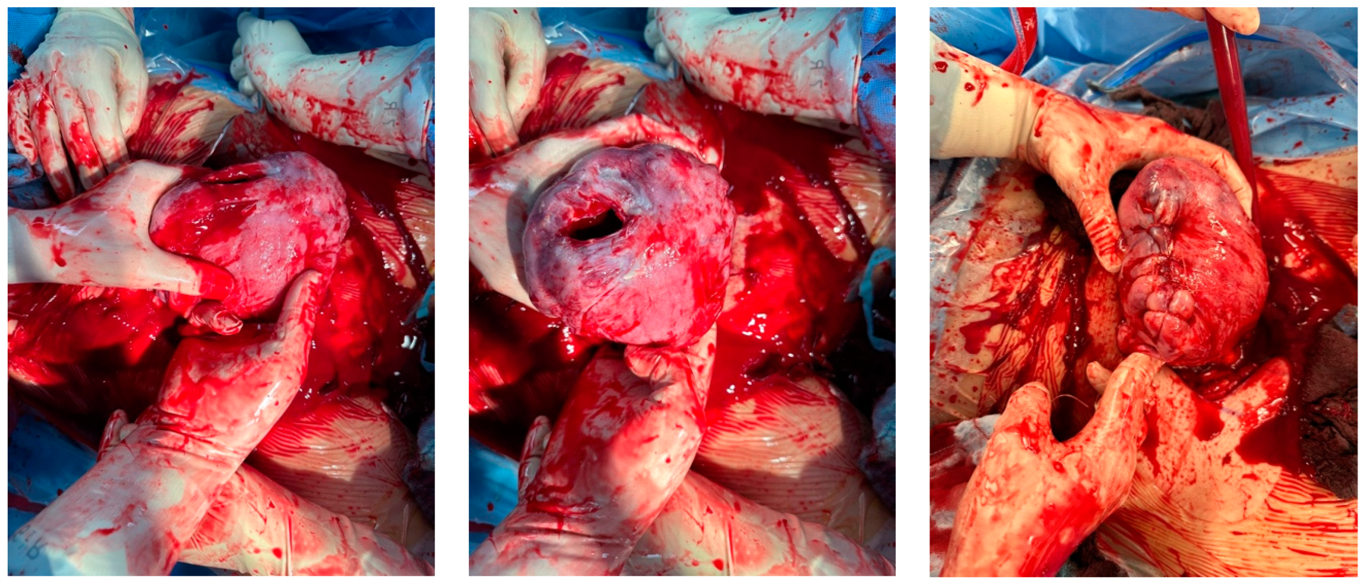 Medicina 60 01180 g015