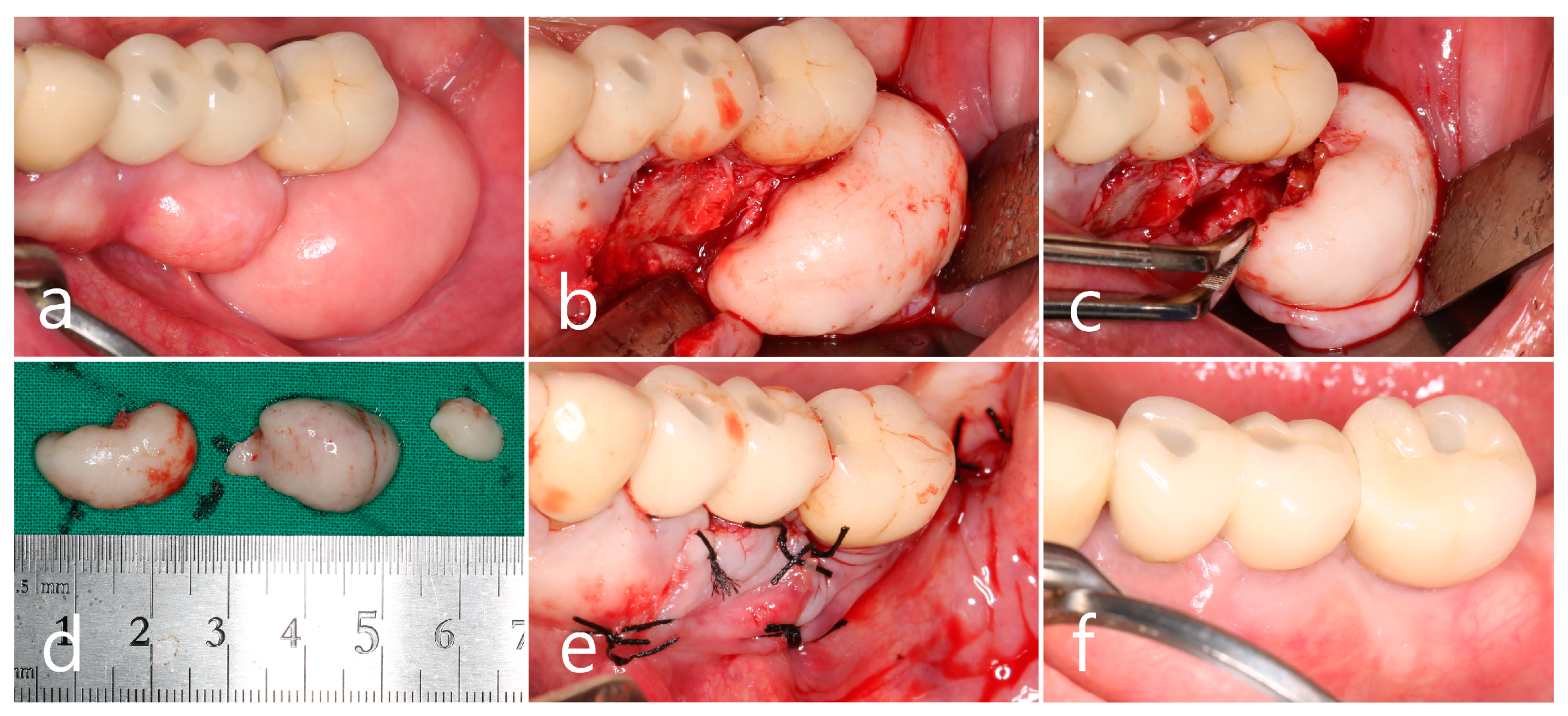 Medicina 60 01181 g003