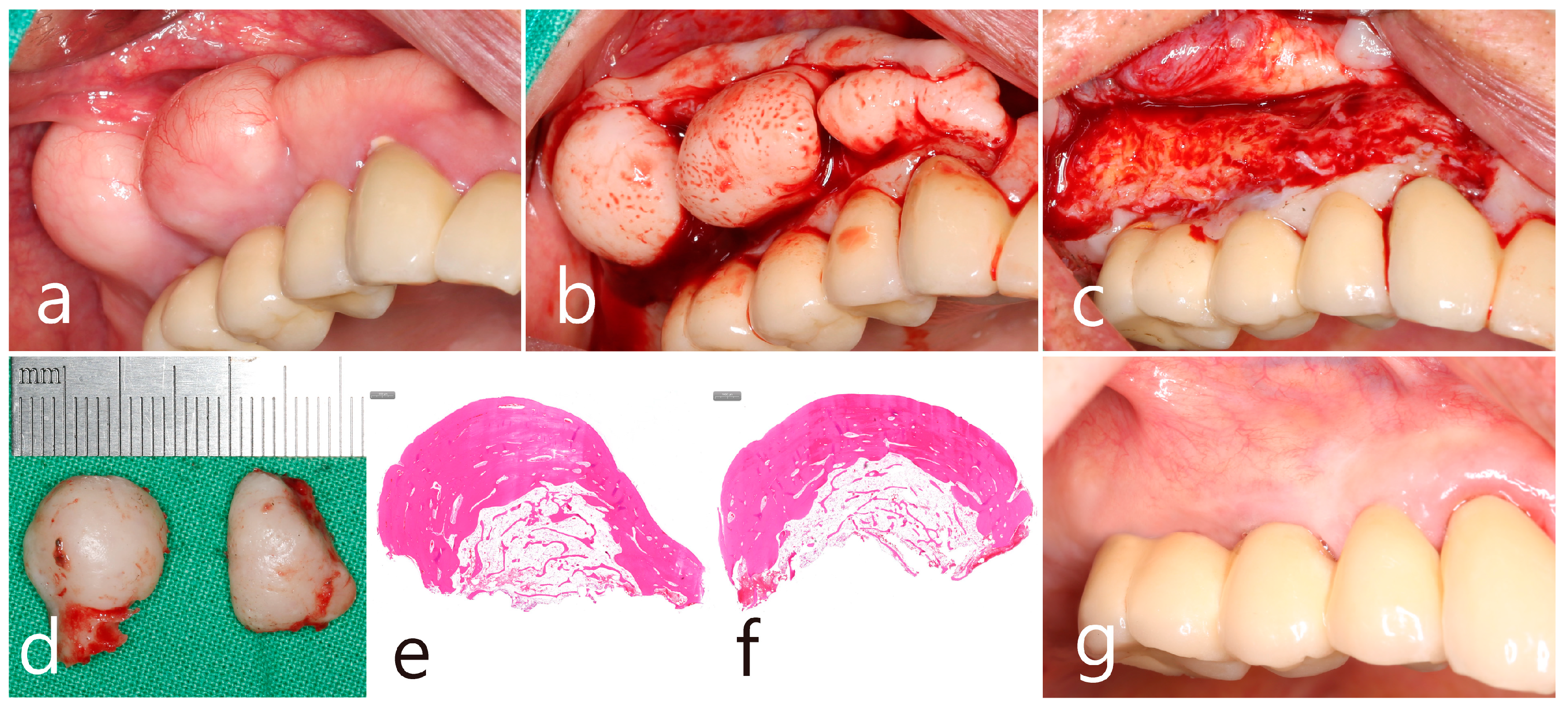 Medicina 60 01181 g005