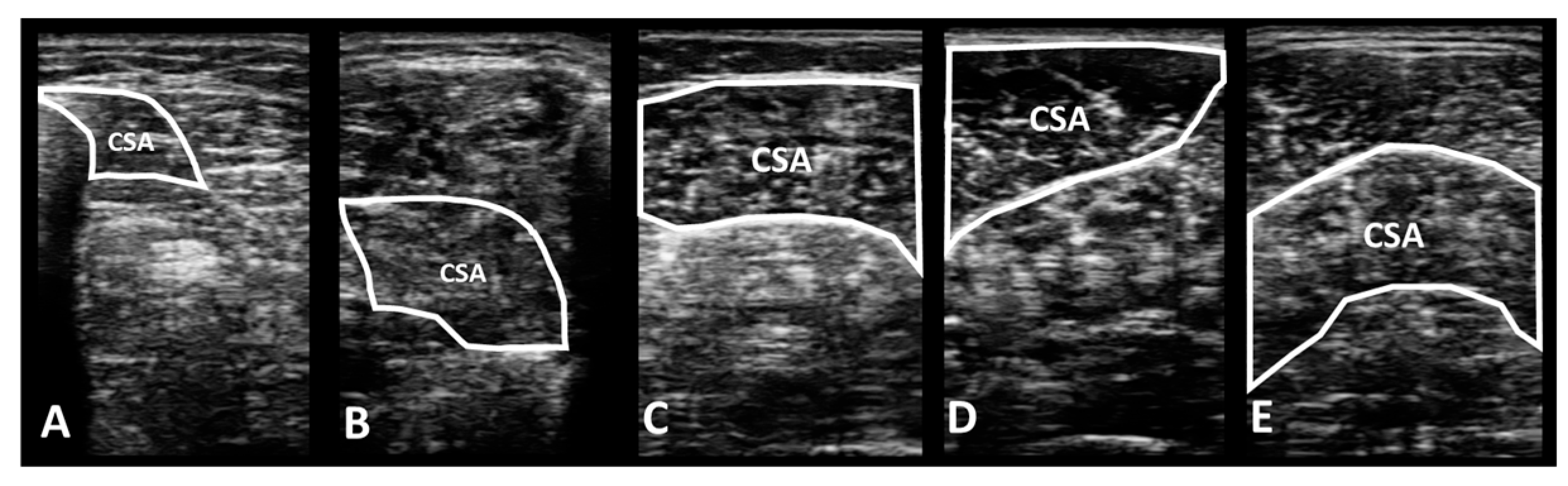 Medicina 60 01187 g004