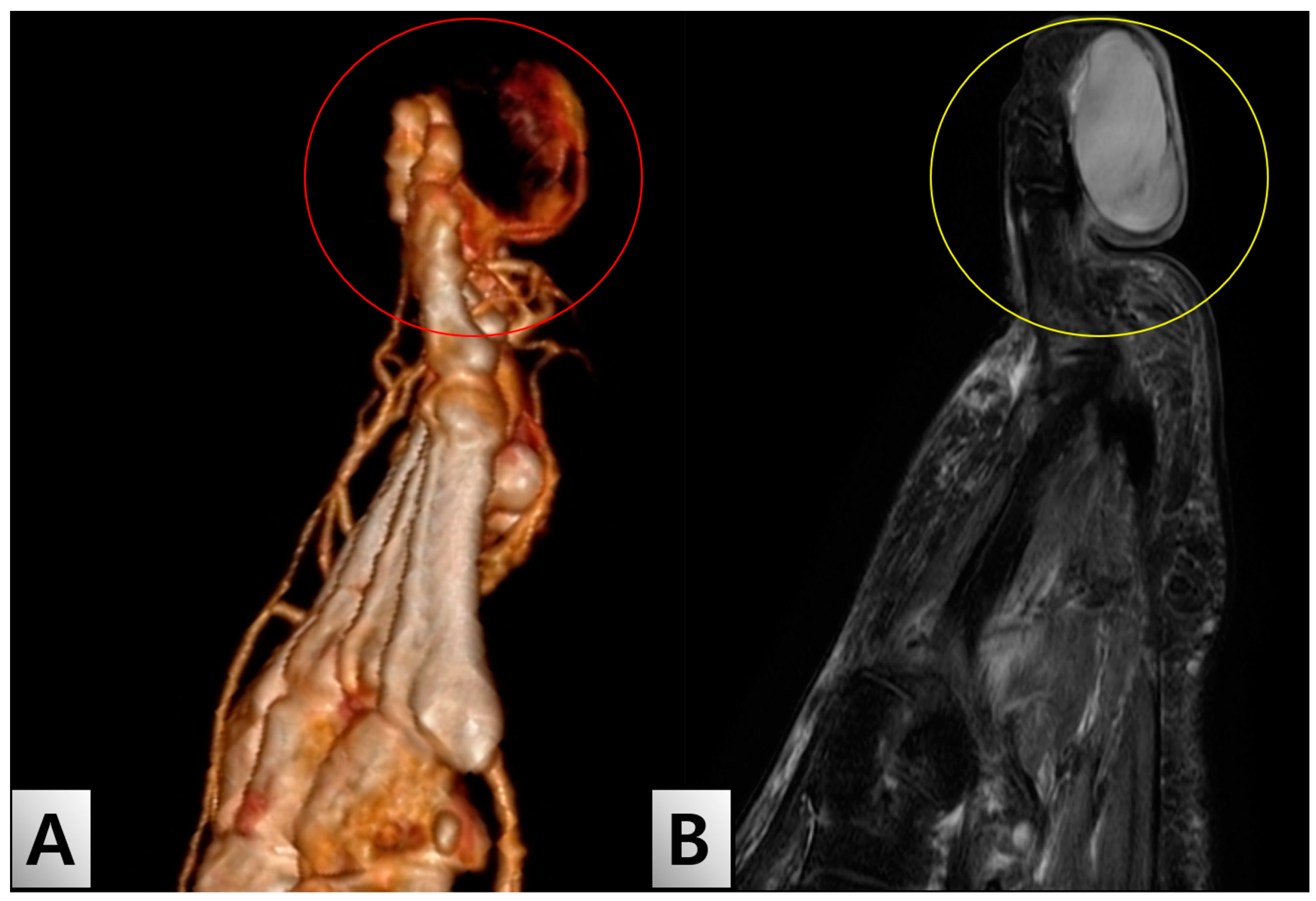 Medicina 60 01200 g002