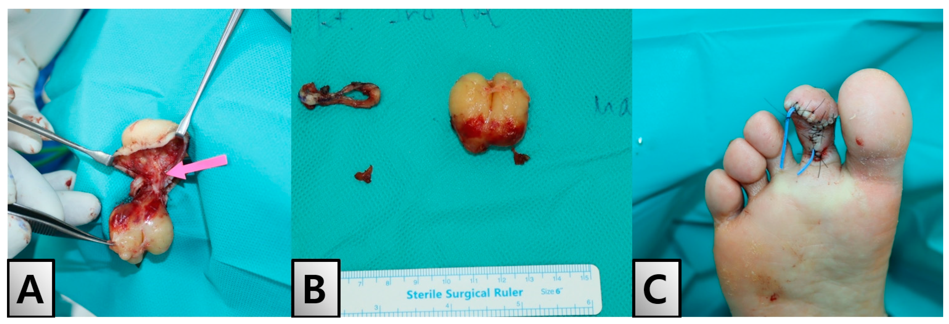 Medicina 60 01200 g004