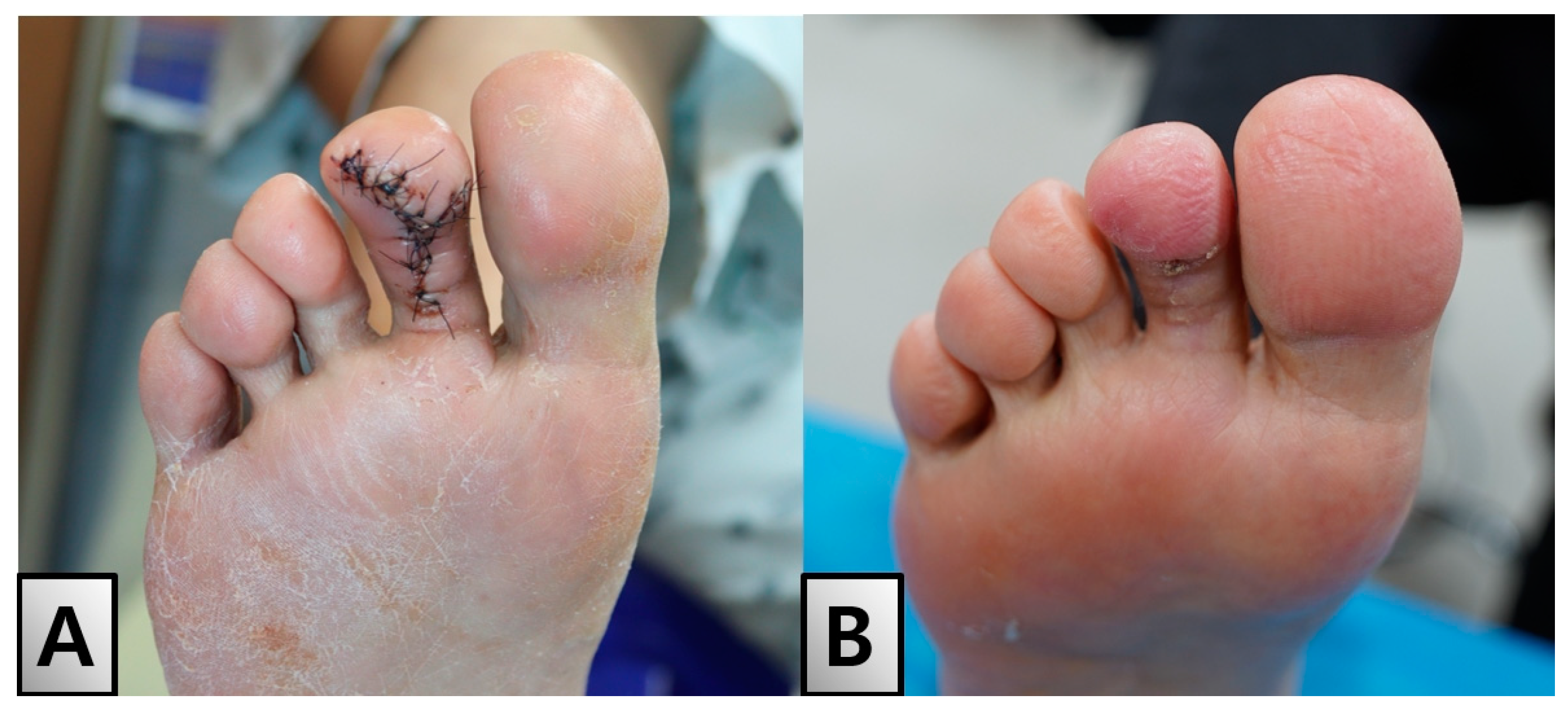 Medicina 60 01200 g005