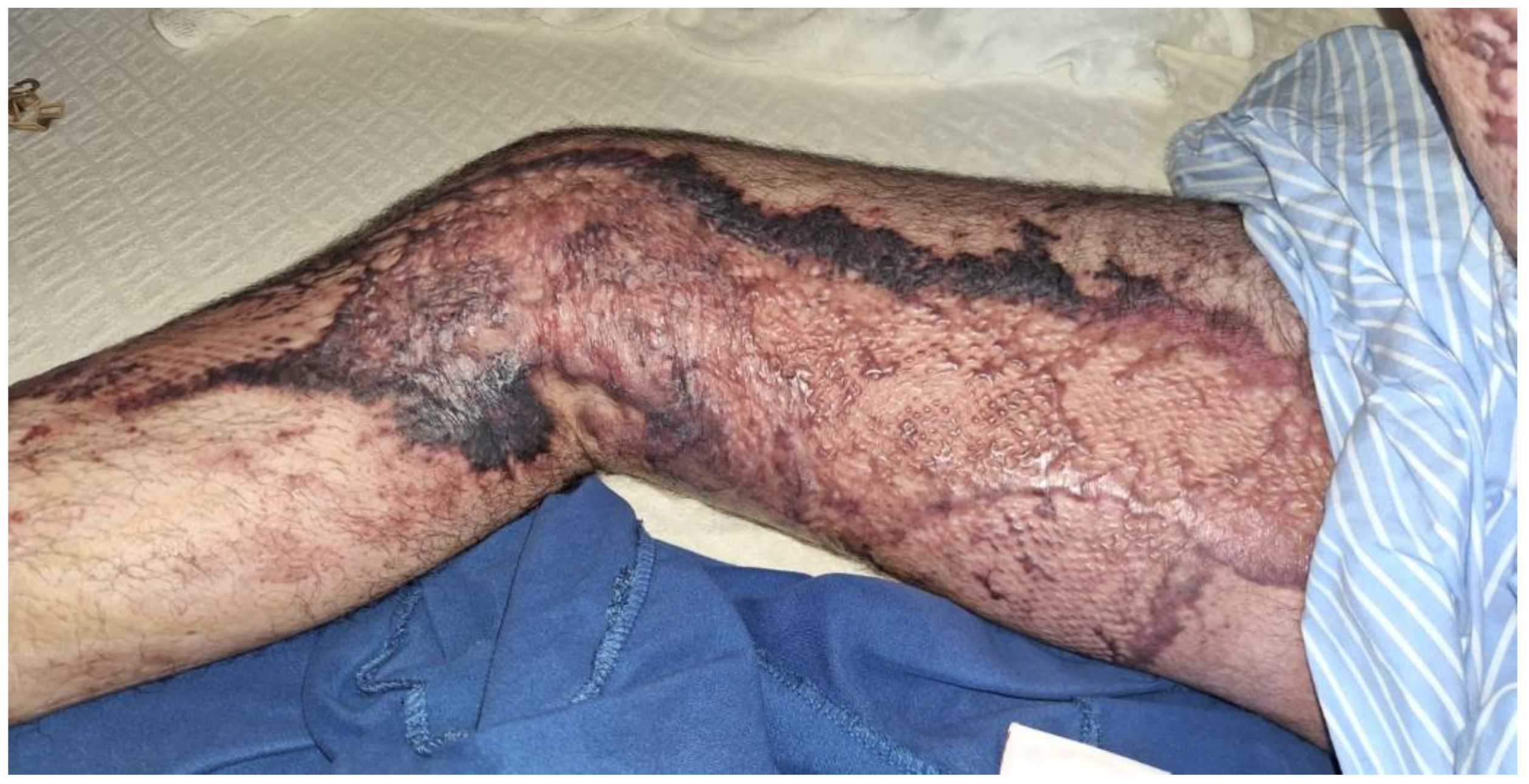 Medicina 60 01201 g003