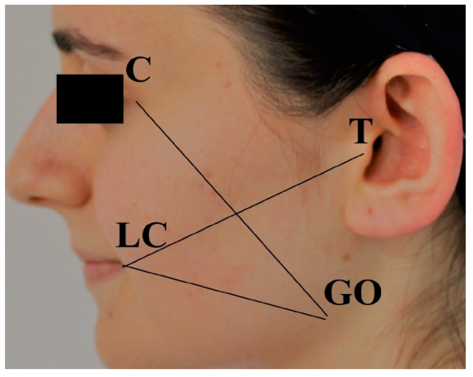 Medicina 60 01206 g002 Medicina 60 01206 g002