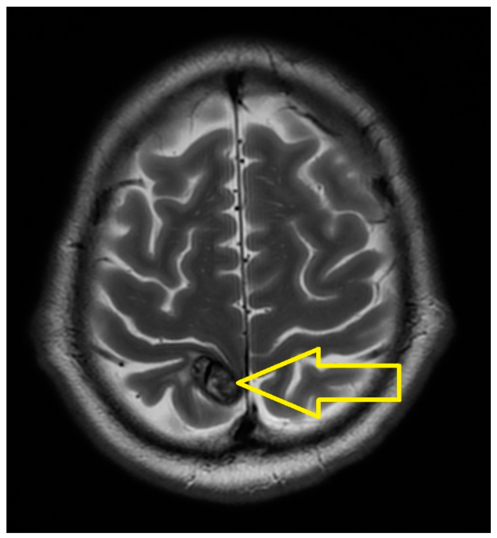 Medicina 60 01225 g003