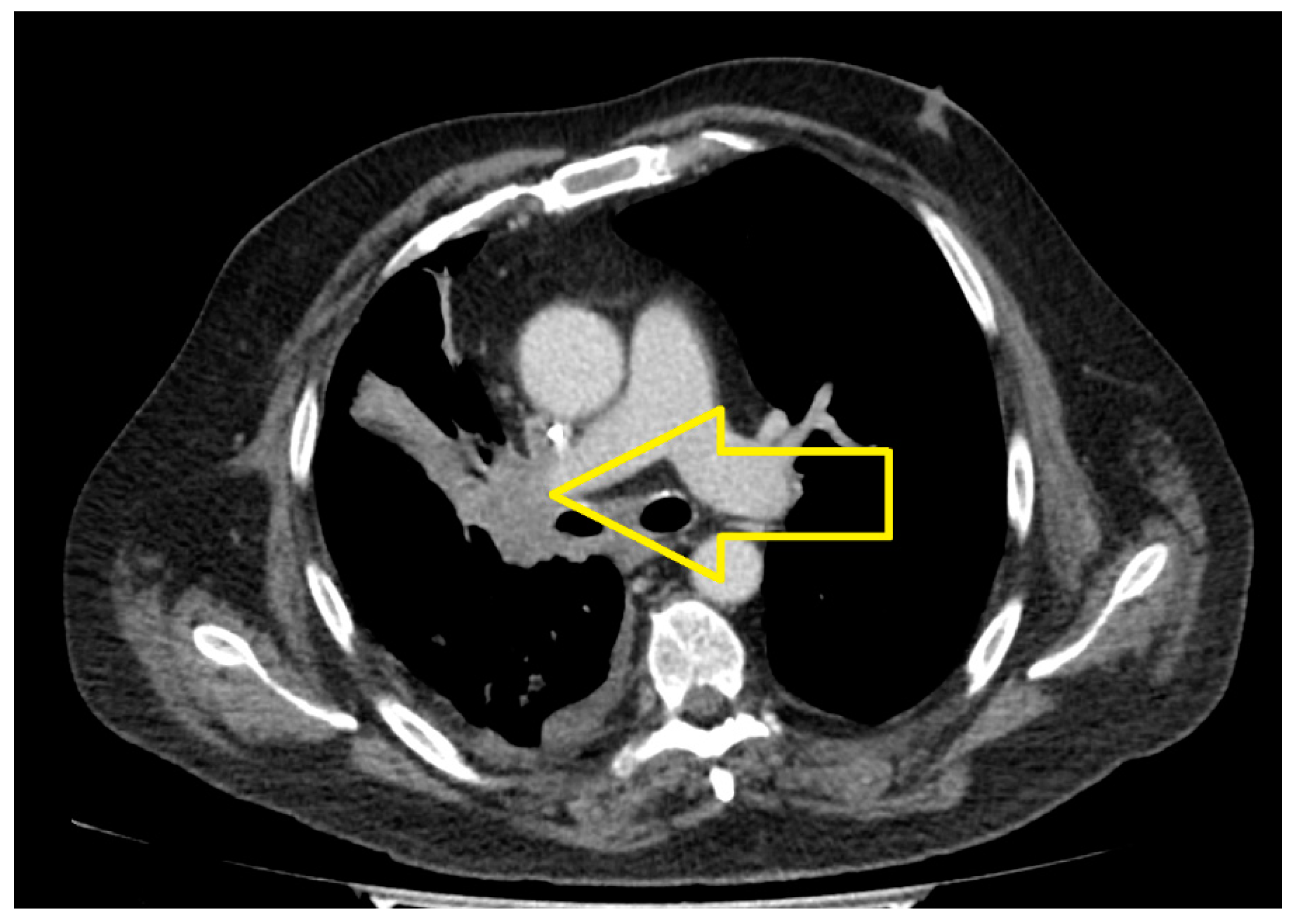 Medicina 60 01225 g007