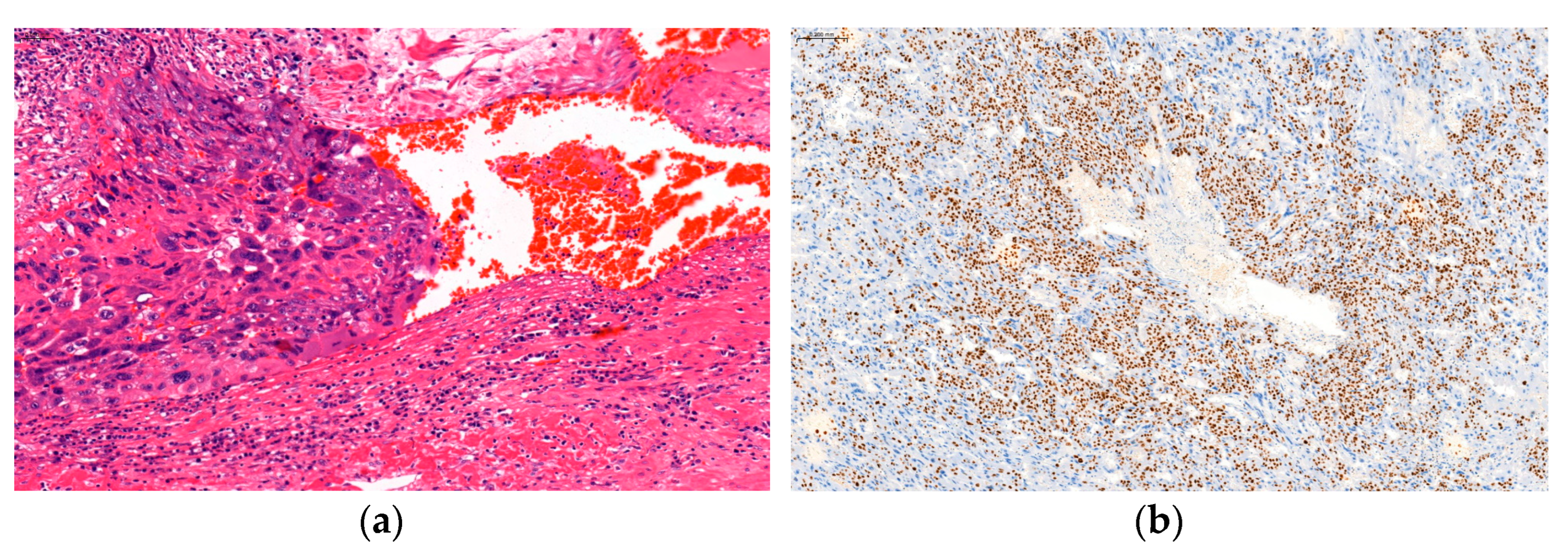 Medicina 60 01226 g002