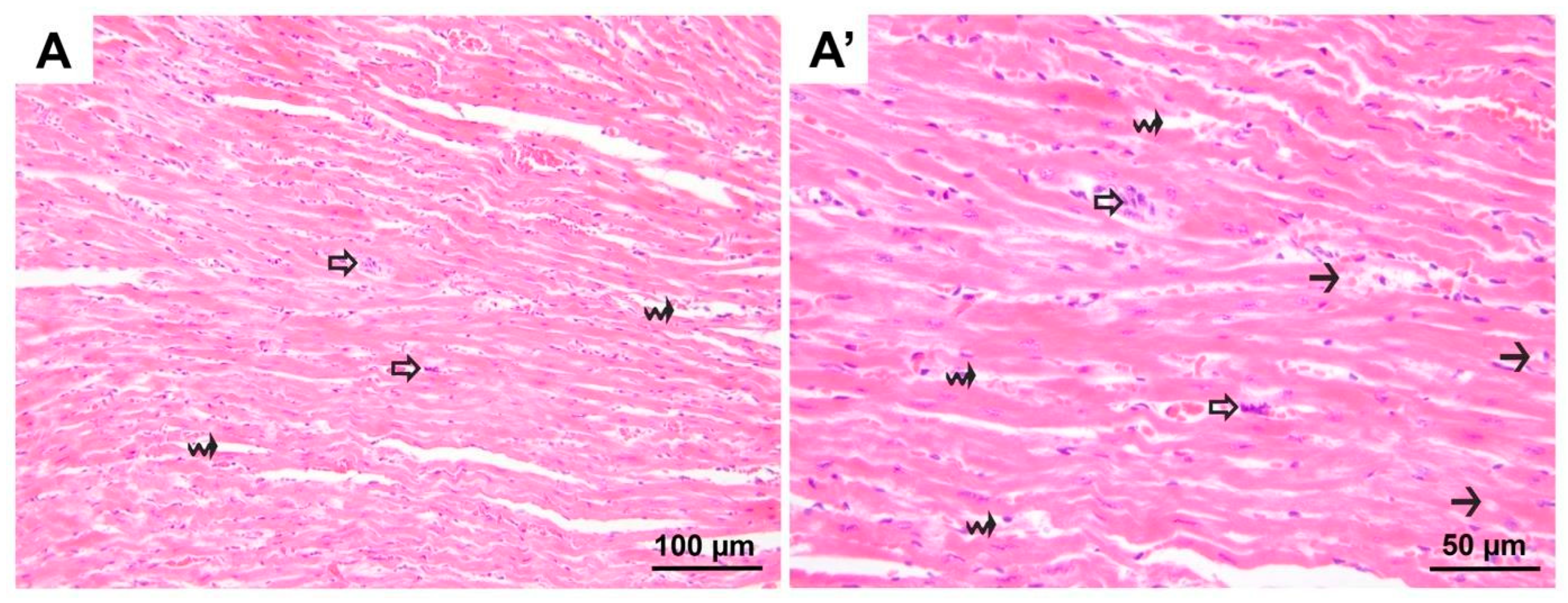 Medicina 60 01232 g005