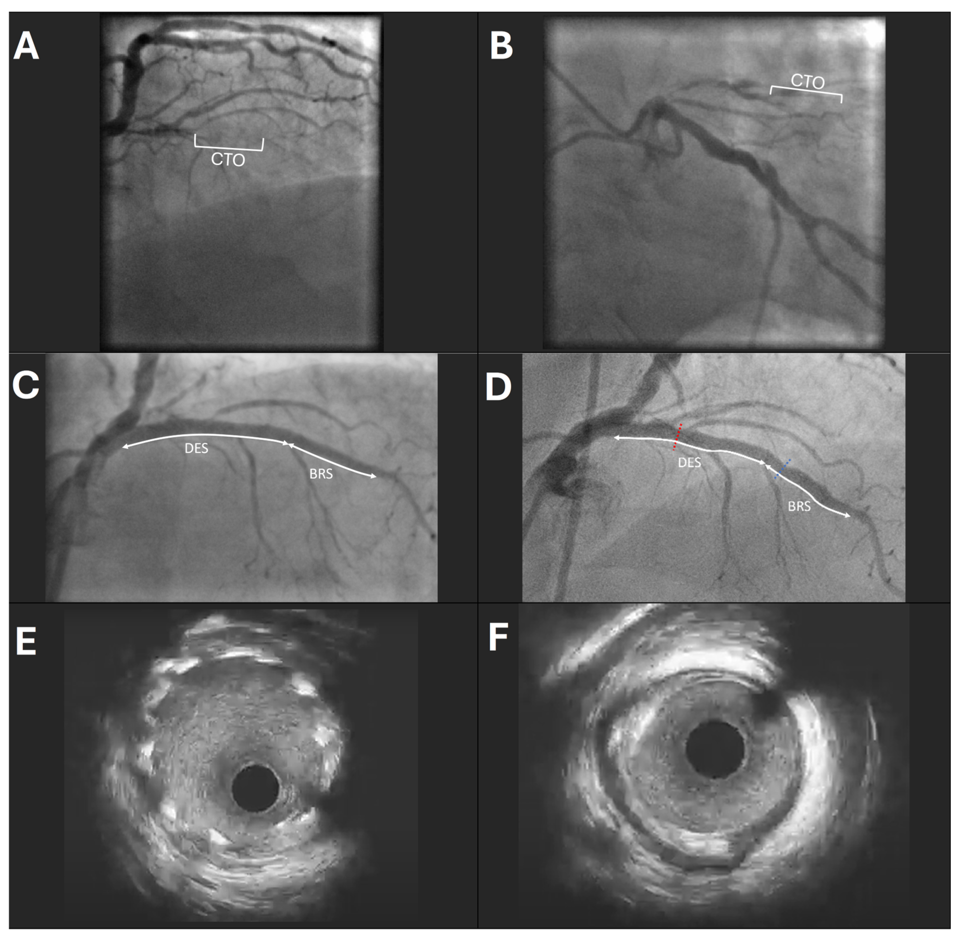 Medicina 60 01233 g001