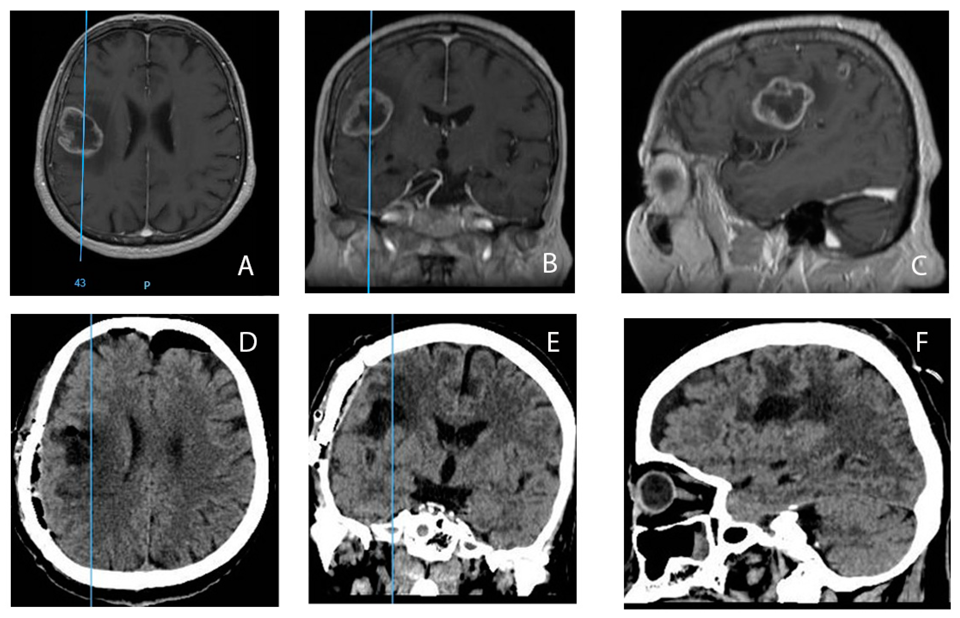 Medicina 60 01234 g009