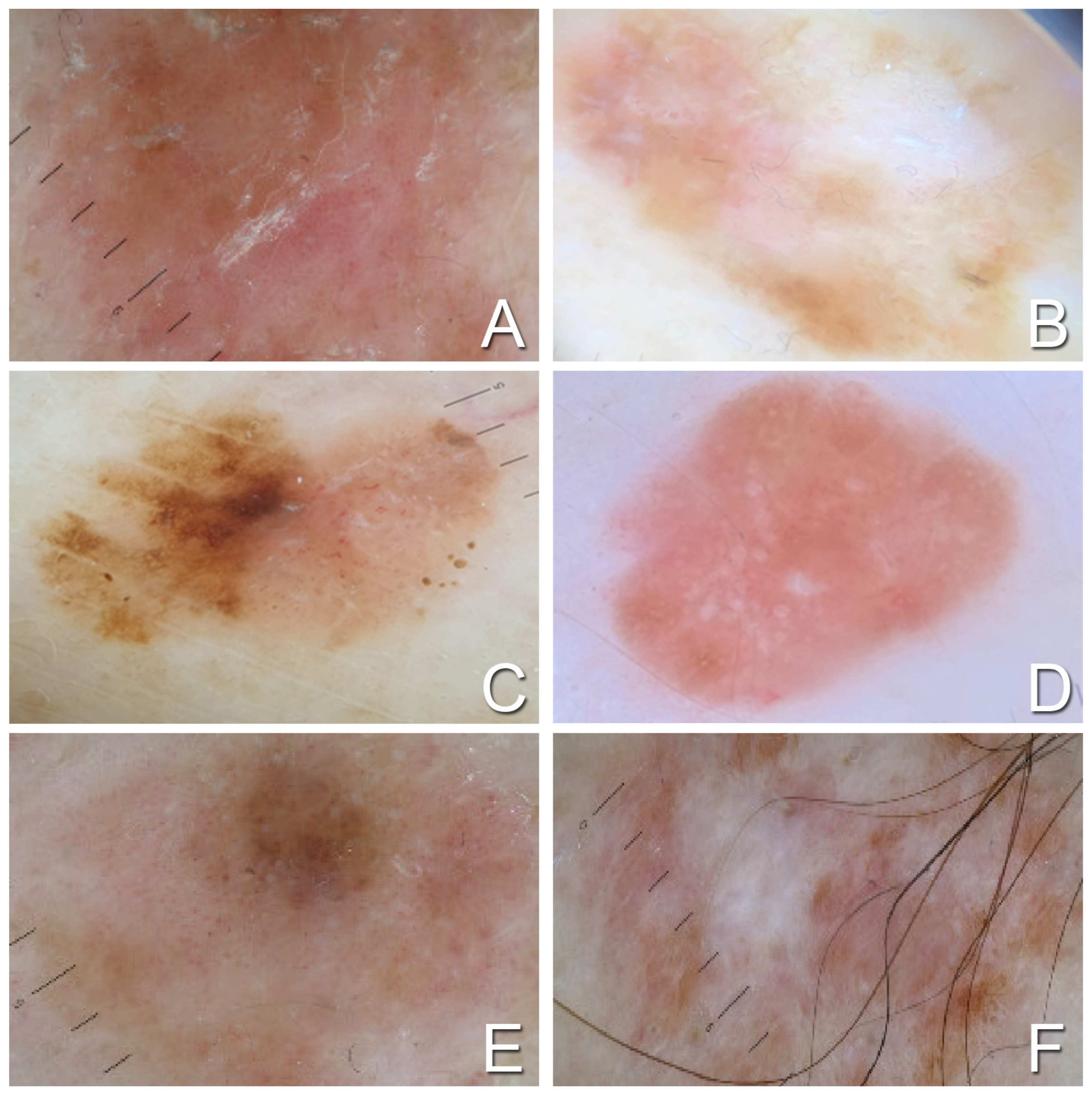 Medicina 60 01239 g001