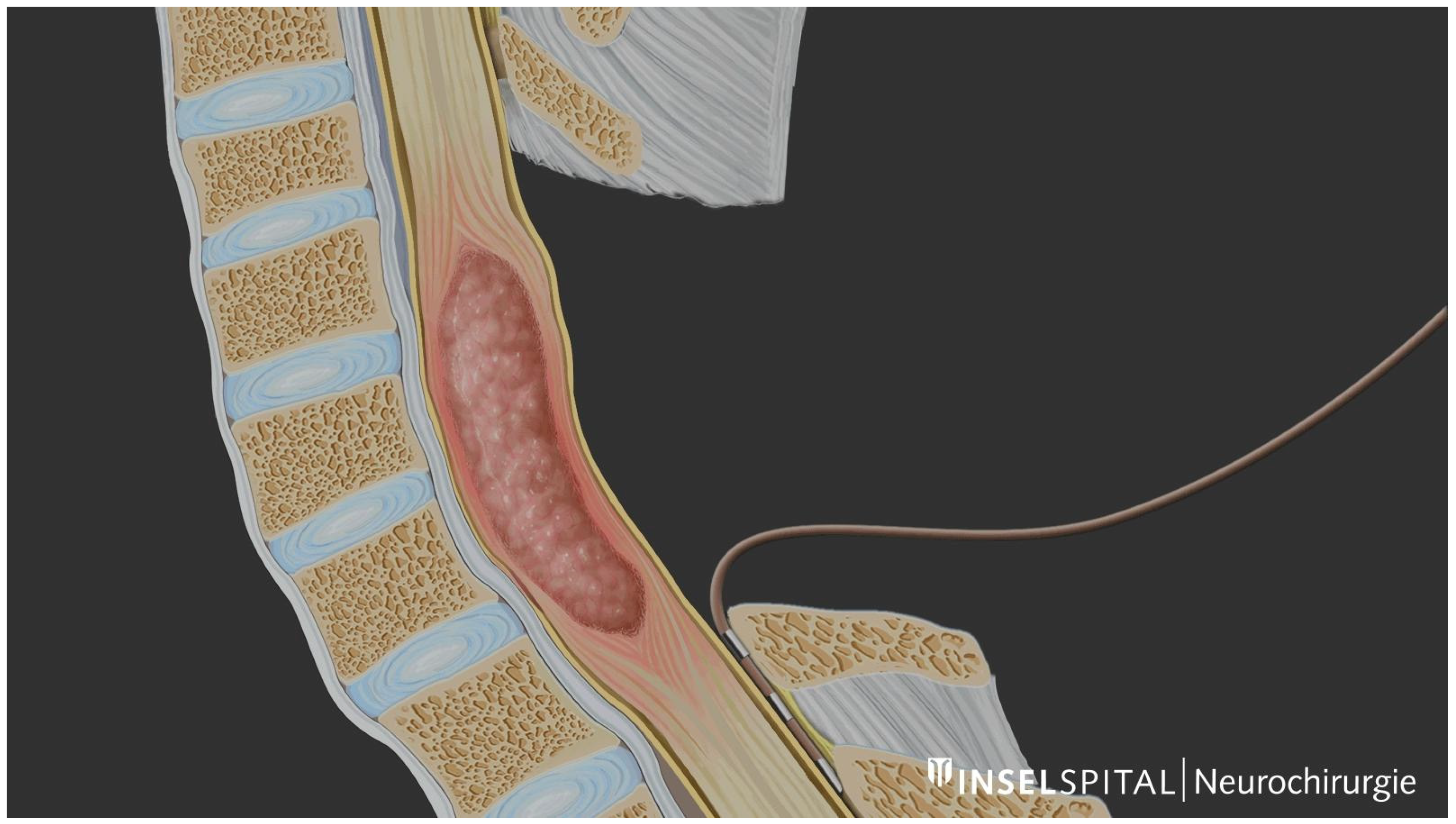 Medicina 60 01242 g001