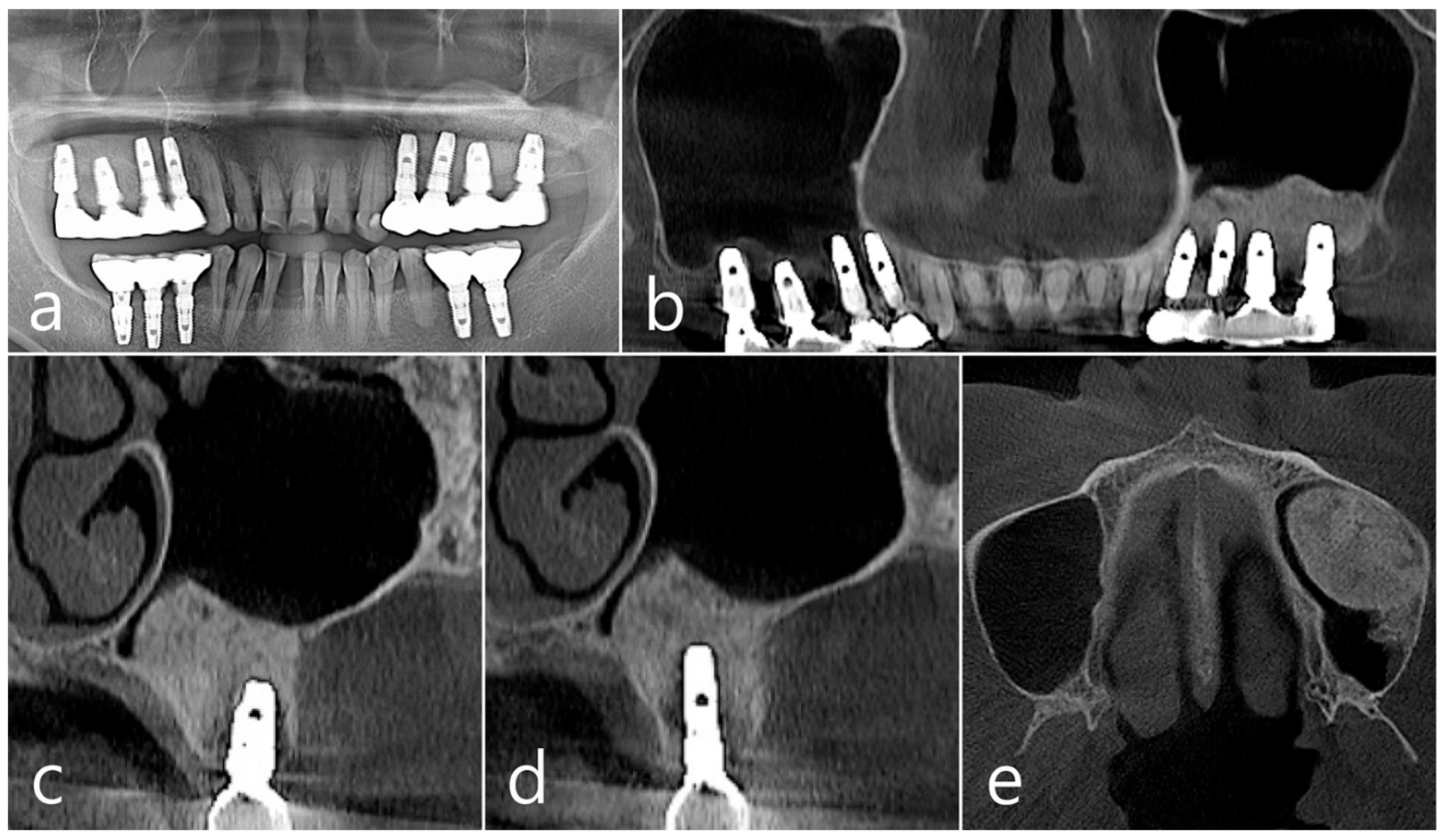 Medicina 60 01246 g003