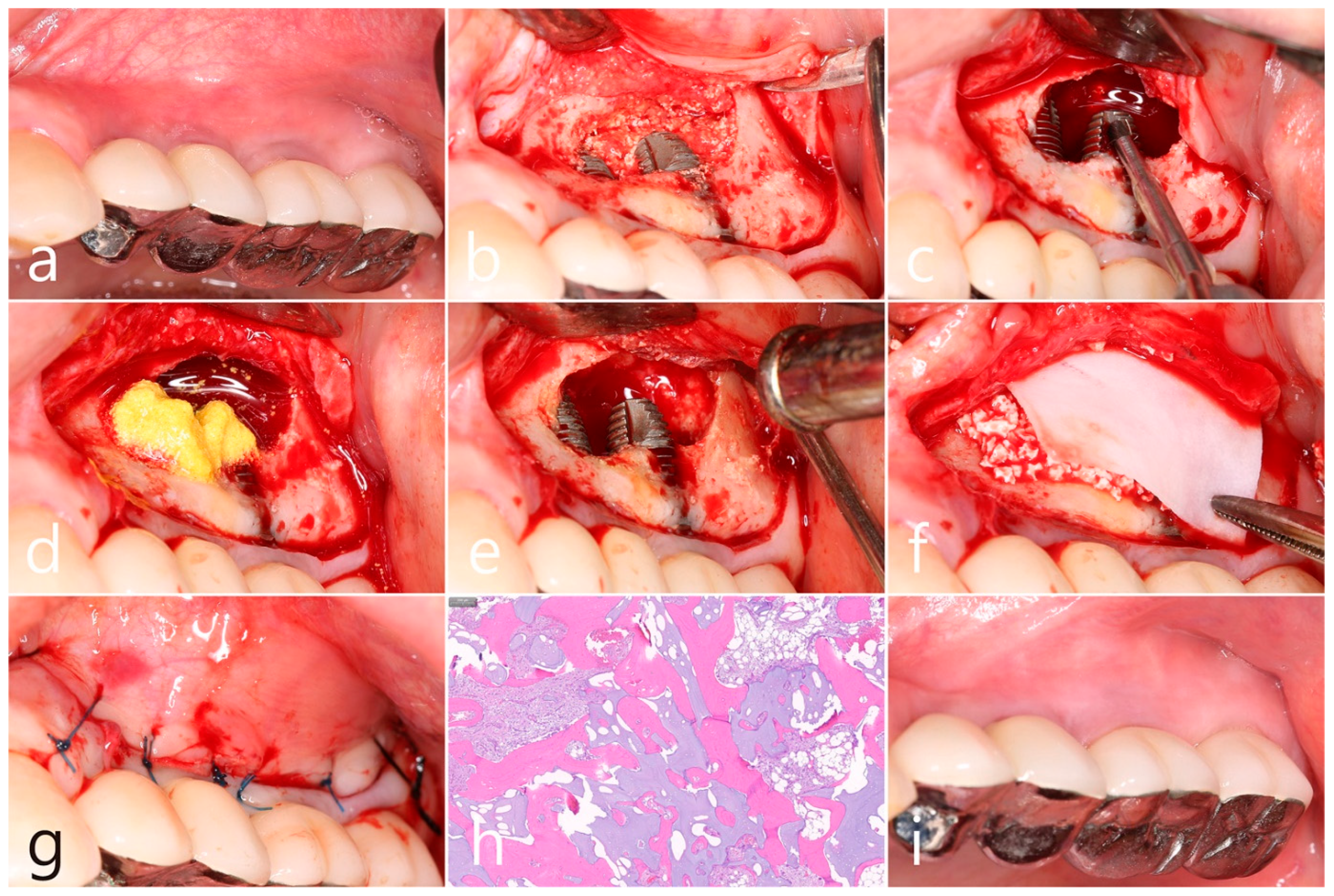 Medicina 60 01246 g005