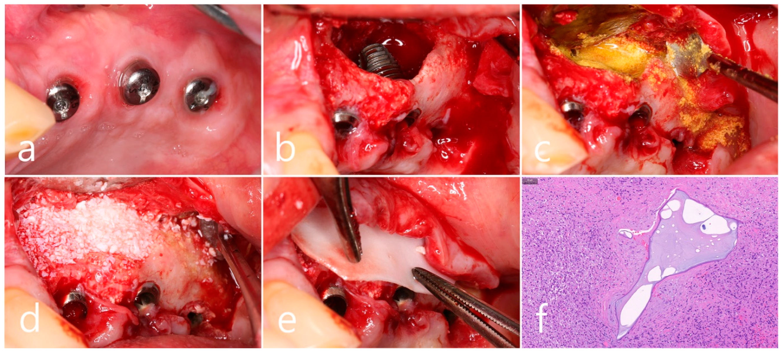 Medicina 60 01246 g009