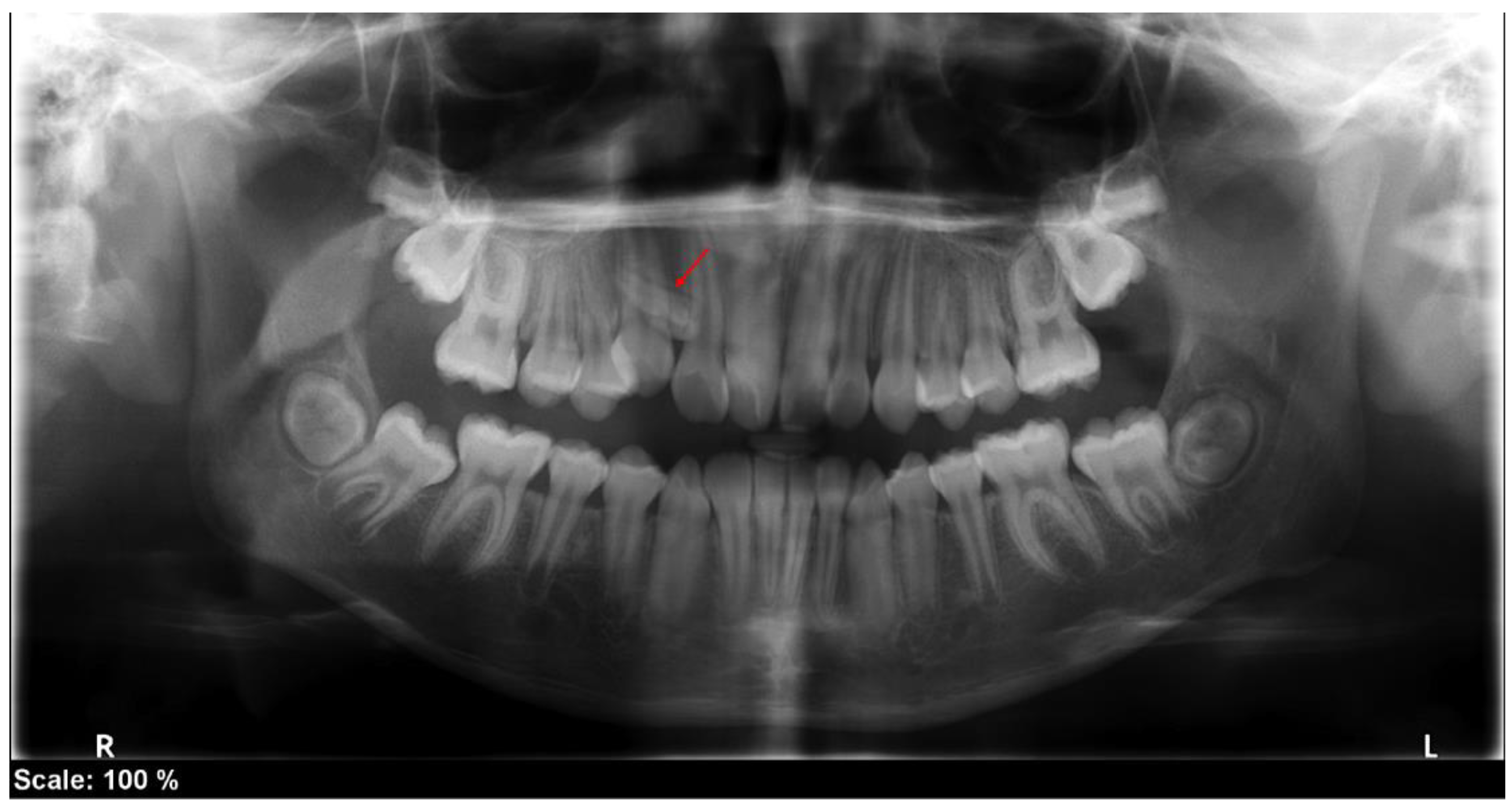 Medicina 60 01248 g004