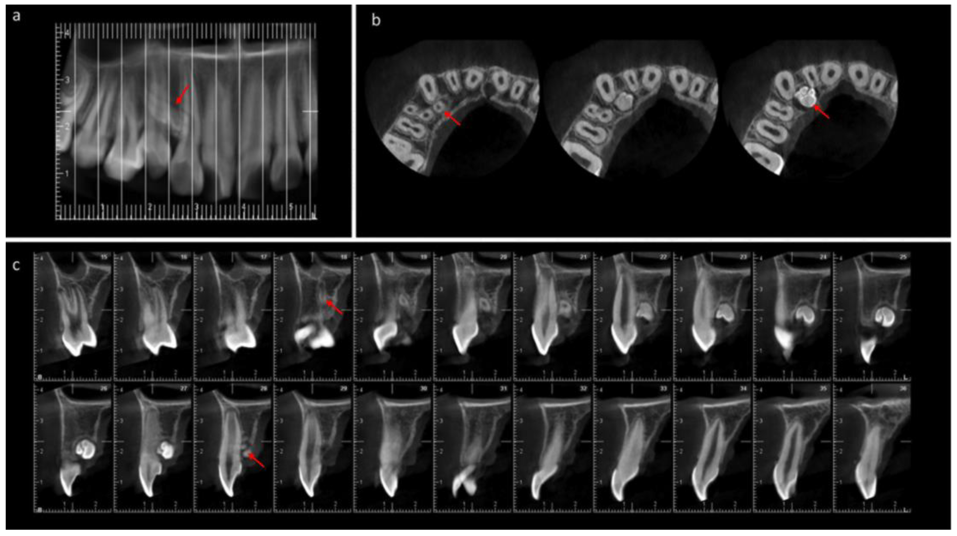 Medicina 60 01248 g005