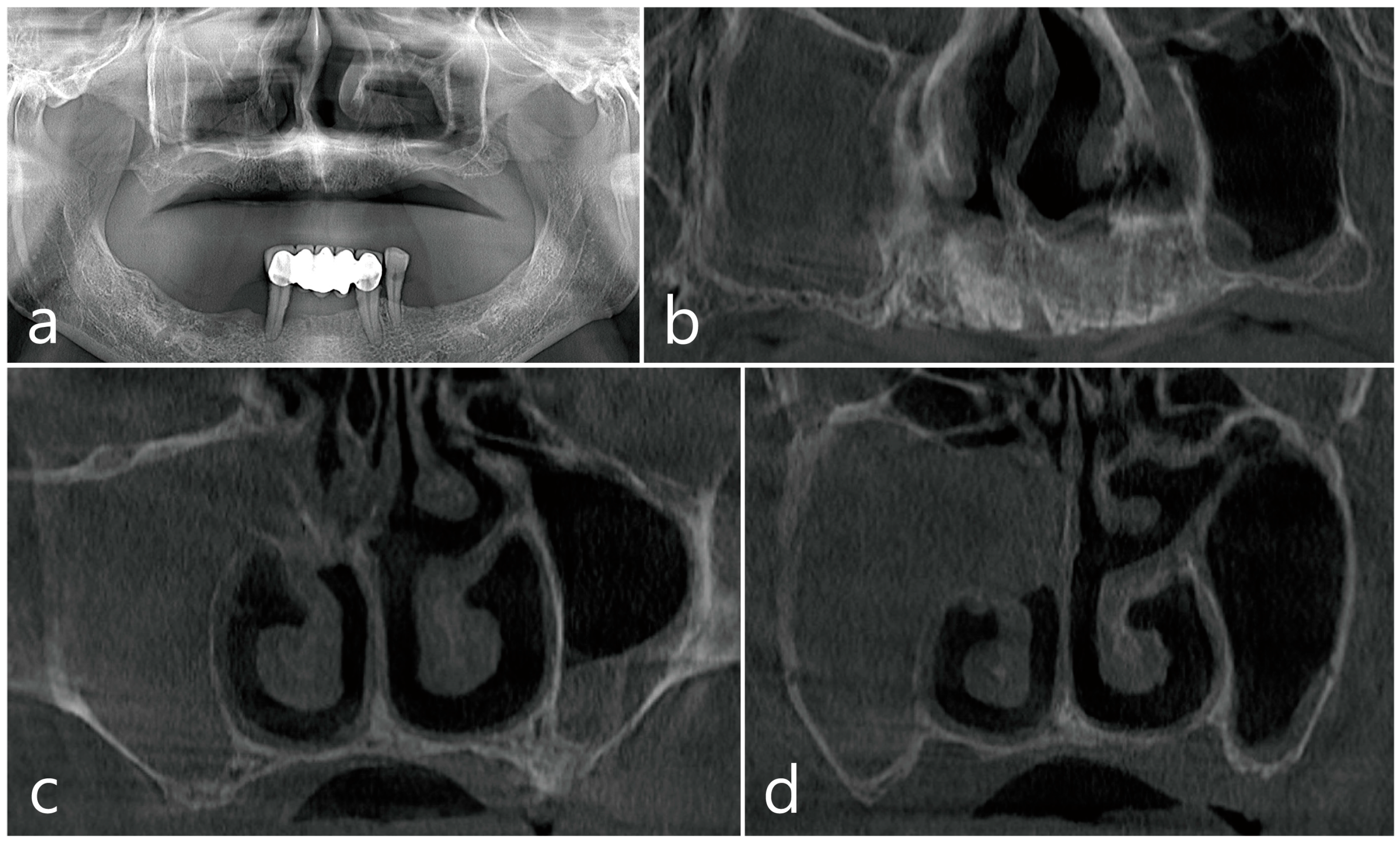 Medicina 60 01256 g001