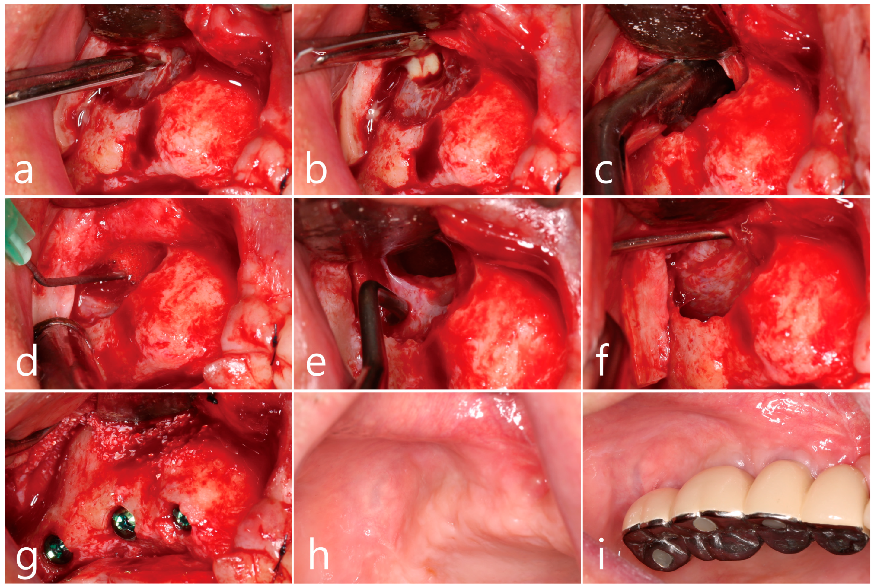Medicina 60 01256 g002