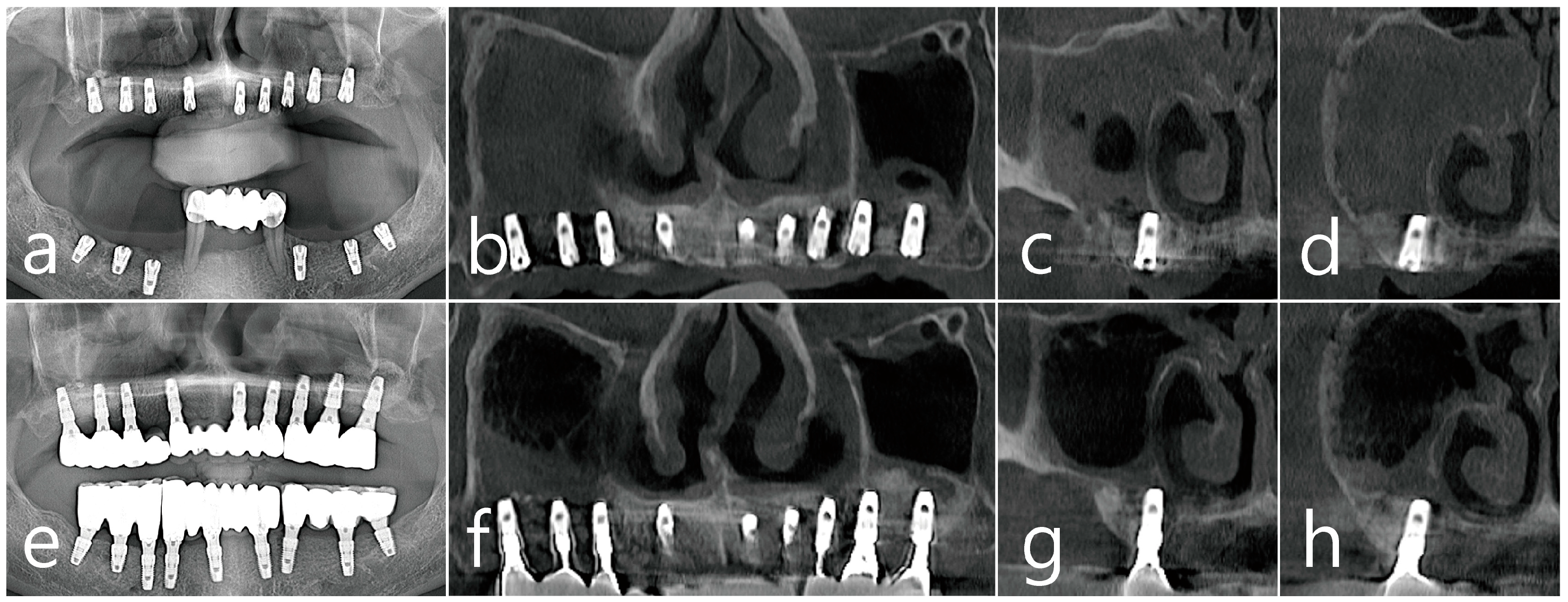 Medicina 60 01256 g003