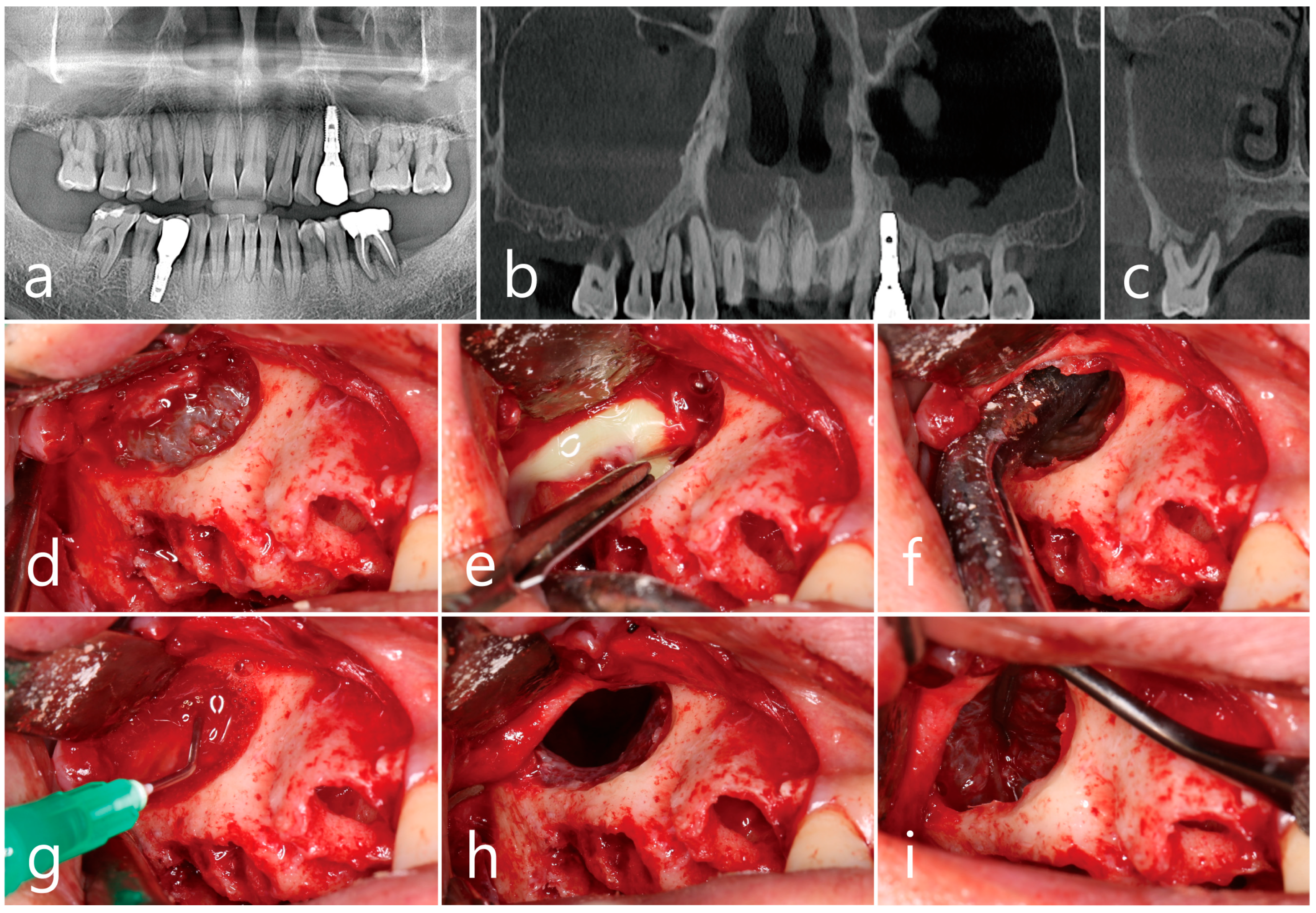 Medicina 60 01256 g004