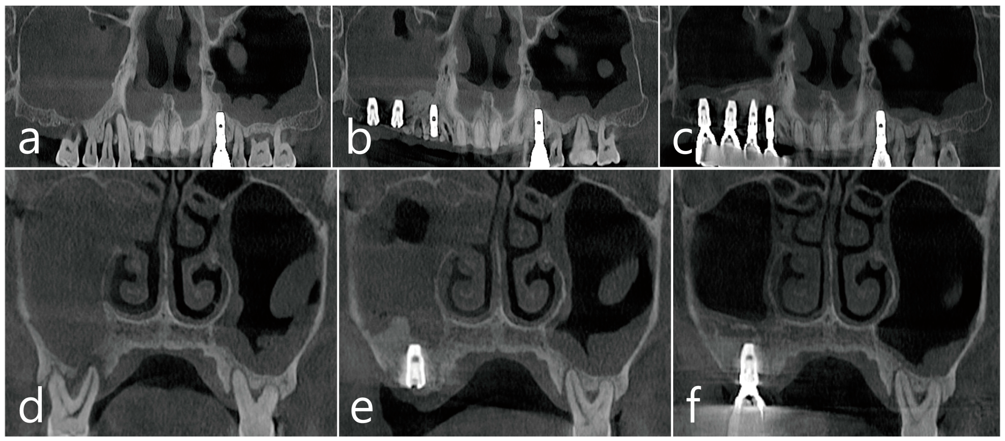 Medicina 60 01256 g006
