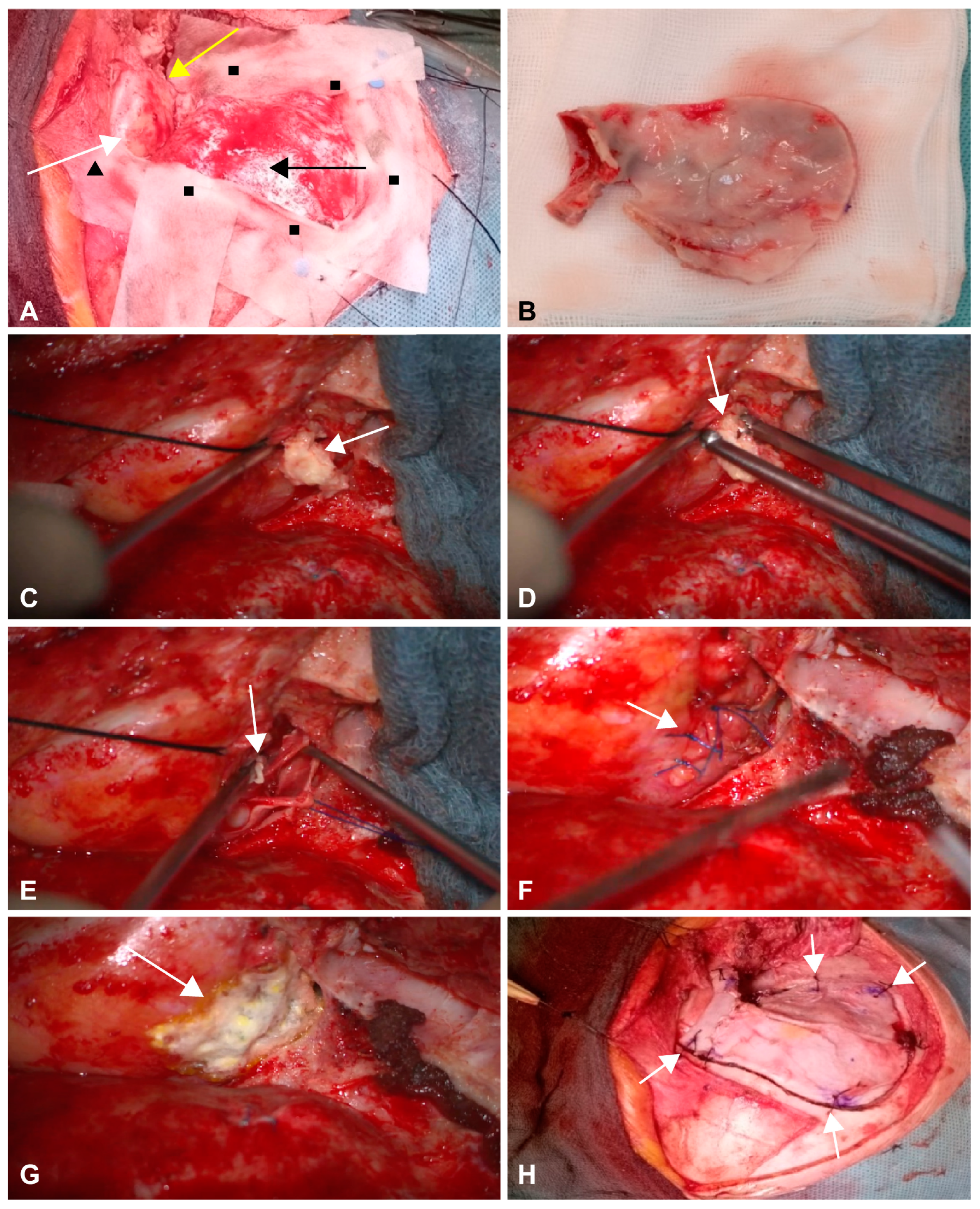 Medicina 60 01267 g003