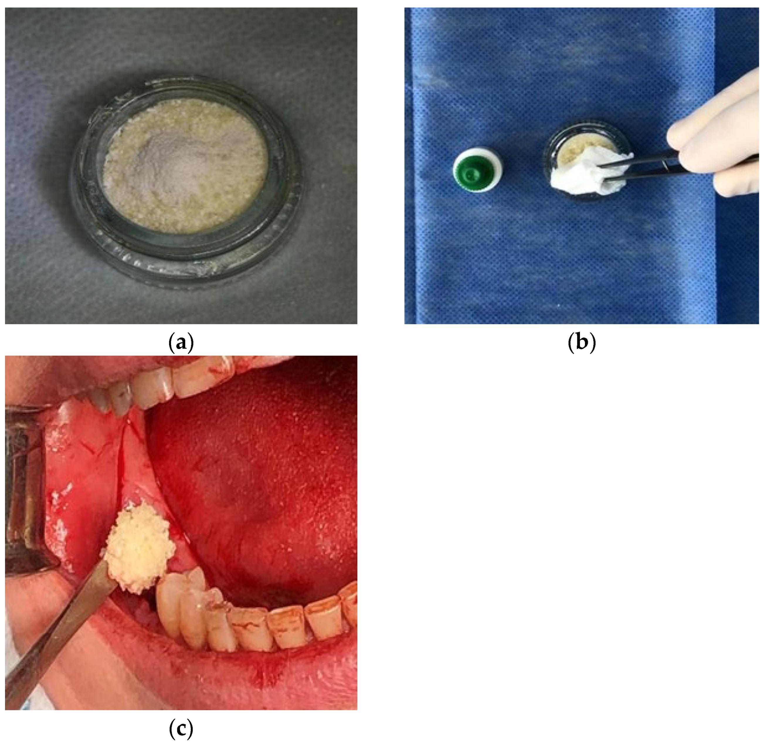 Medicina 60 01280 g004 Medicina 60 01280 g004