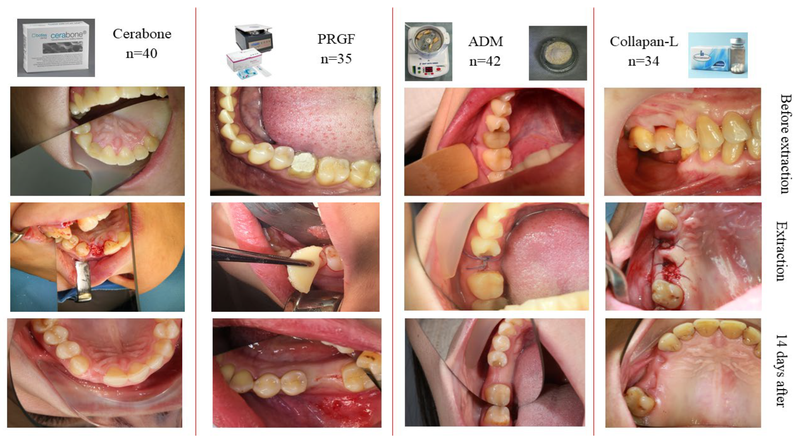 Medicina 60 01280 g005 Medicina 60 01280 g005